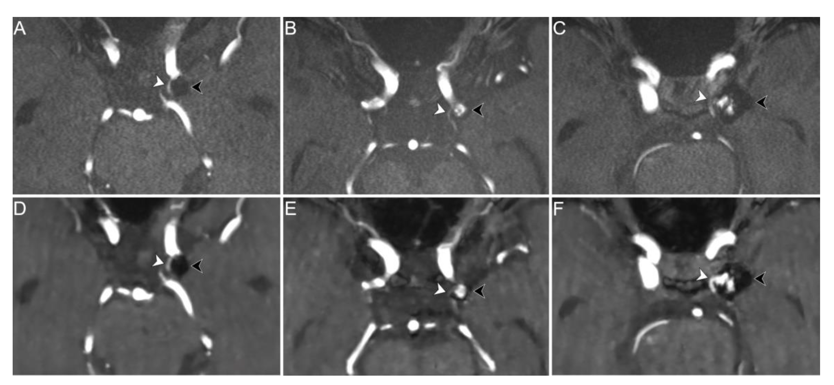 Tomography 08 00133 g004