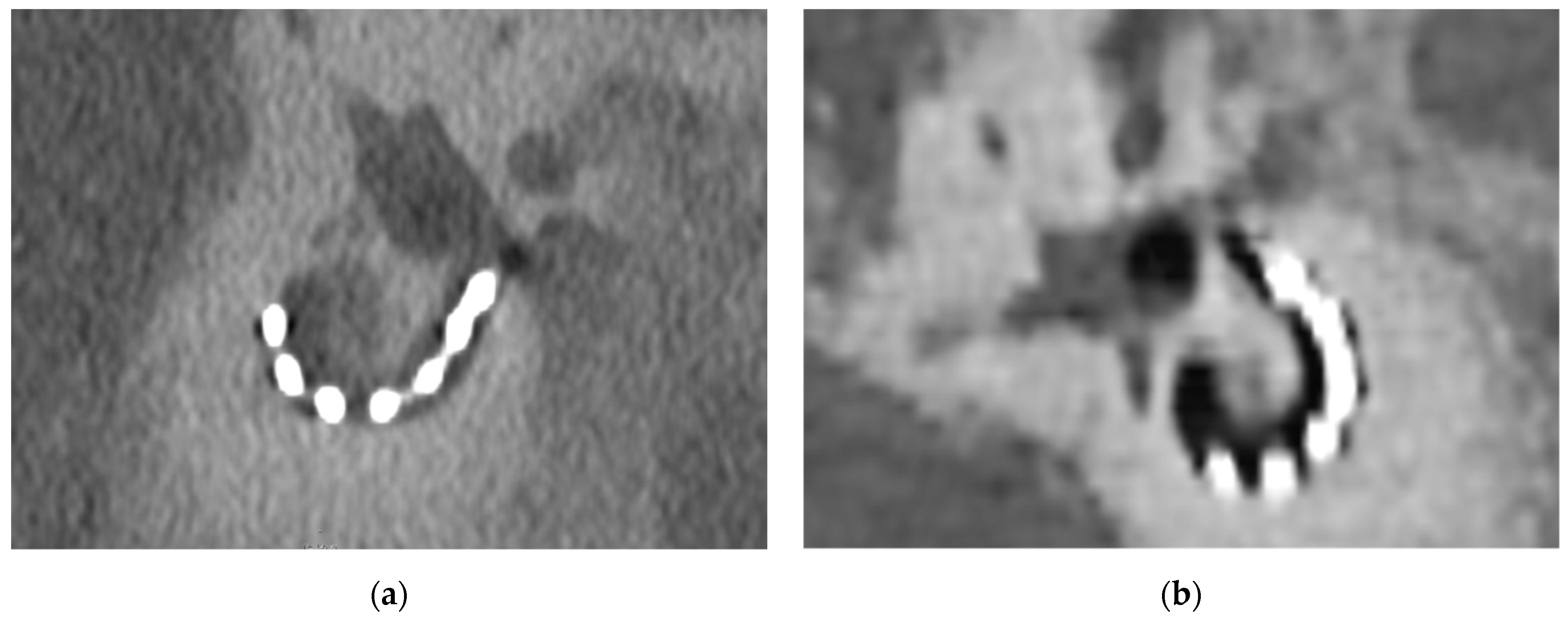 Tomography 08 00136 g002