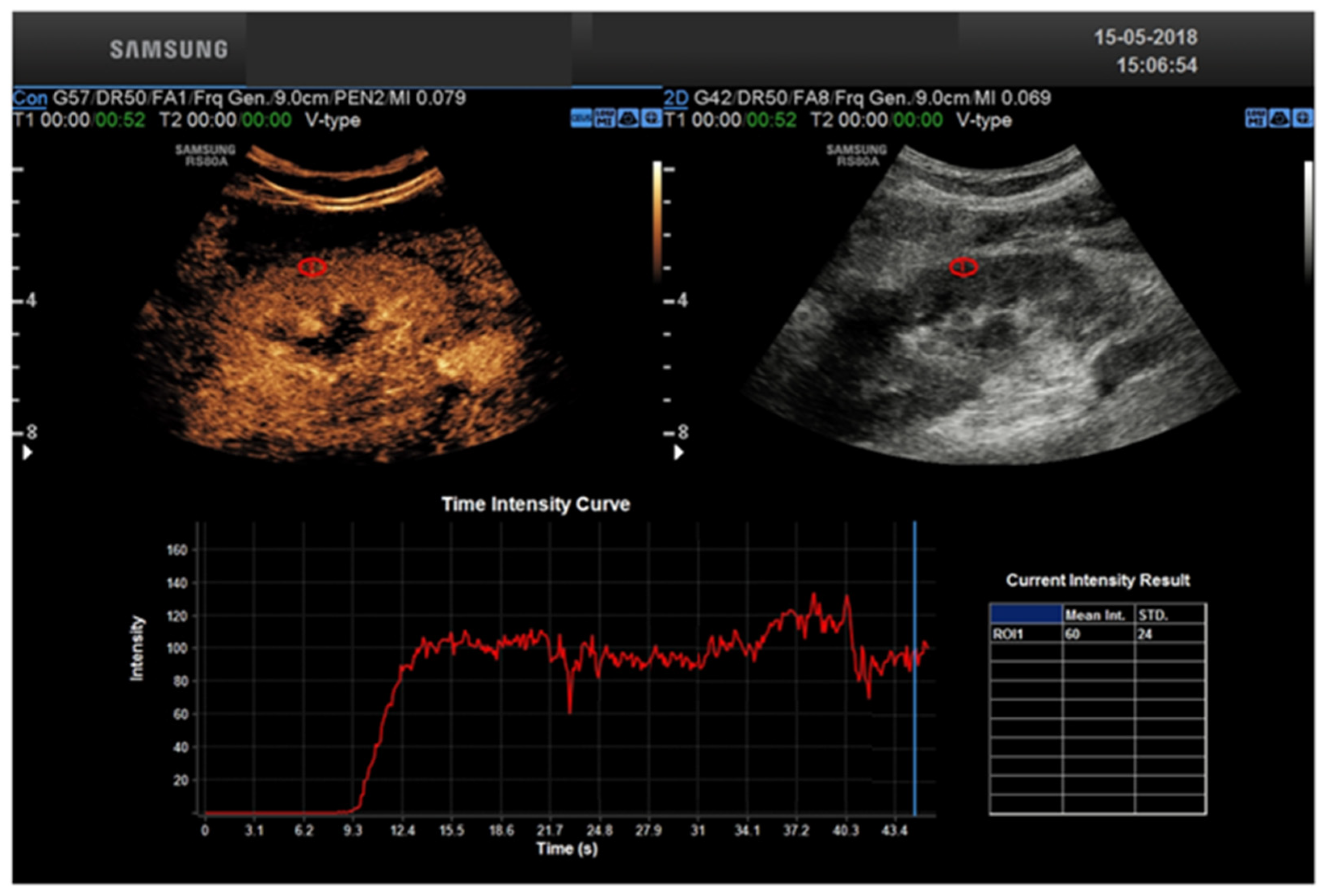 Tomography 08 00143 g002 Tomography 08 00143 g002