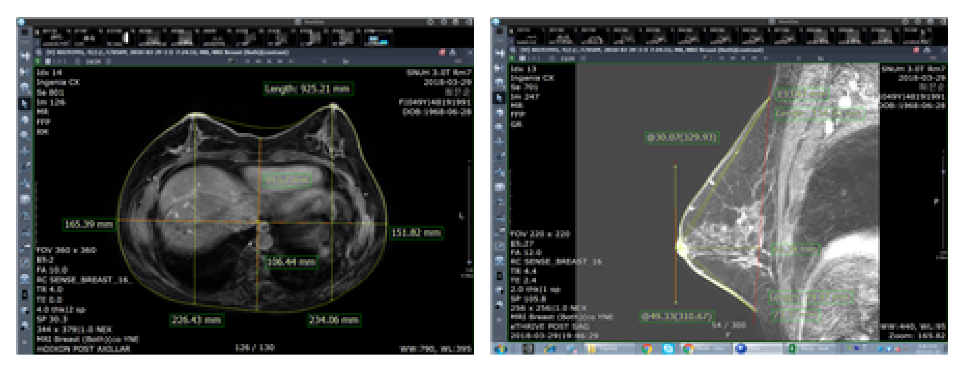 Tomography 08 00153 g002