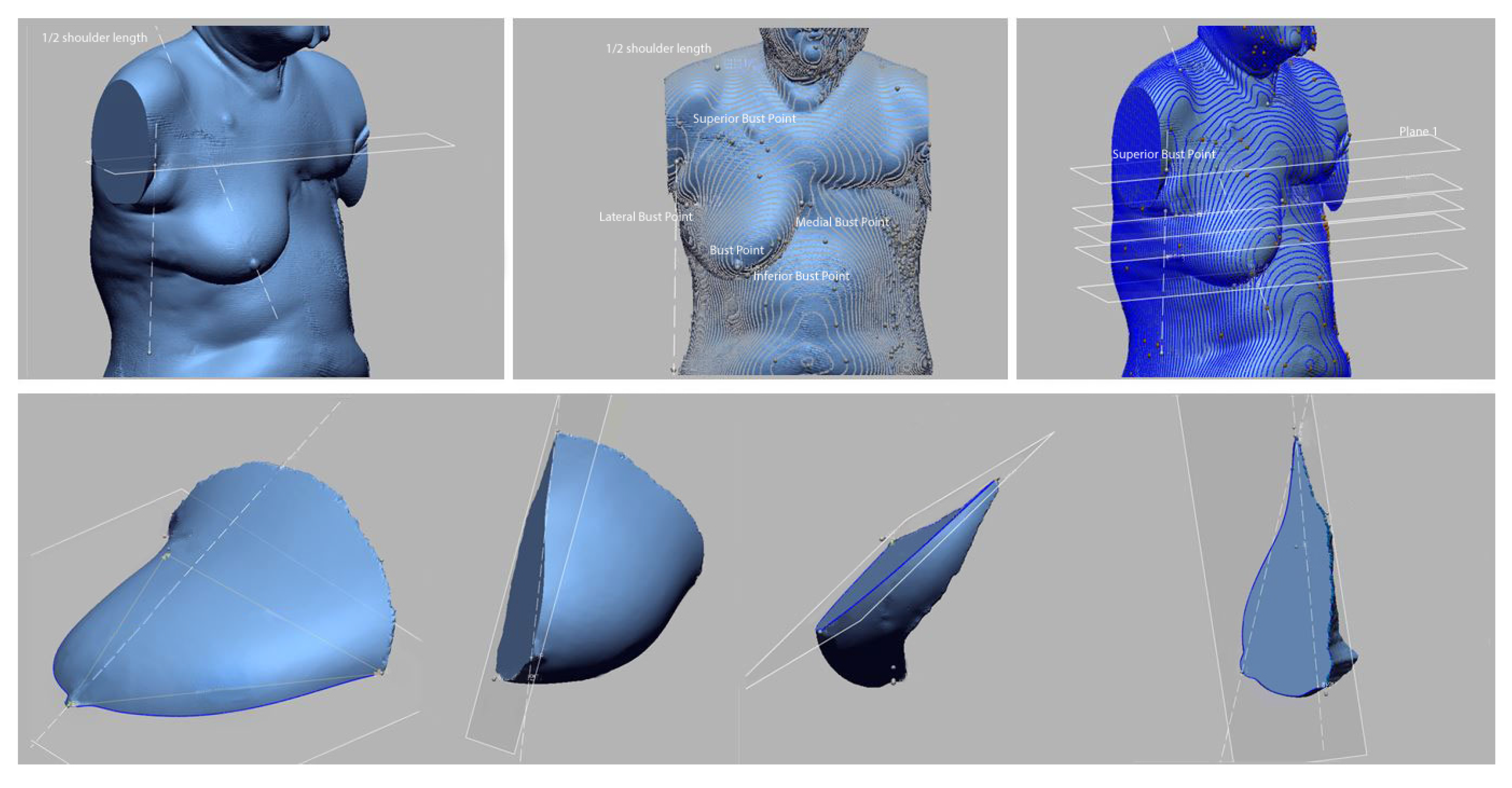 Tomography 08 00153 g005