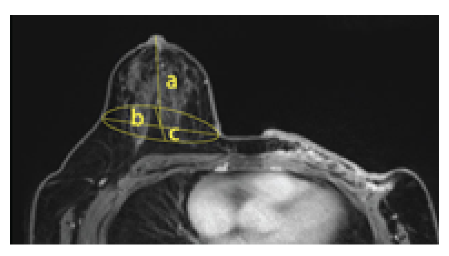 Tomography 08 00153 g007
