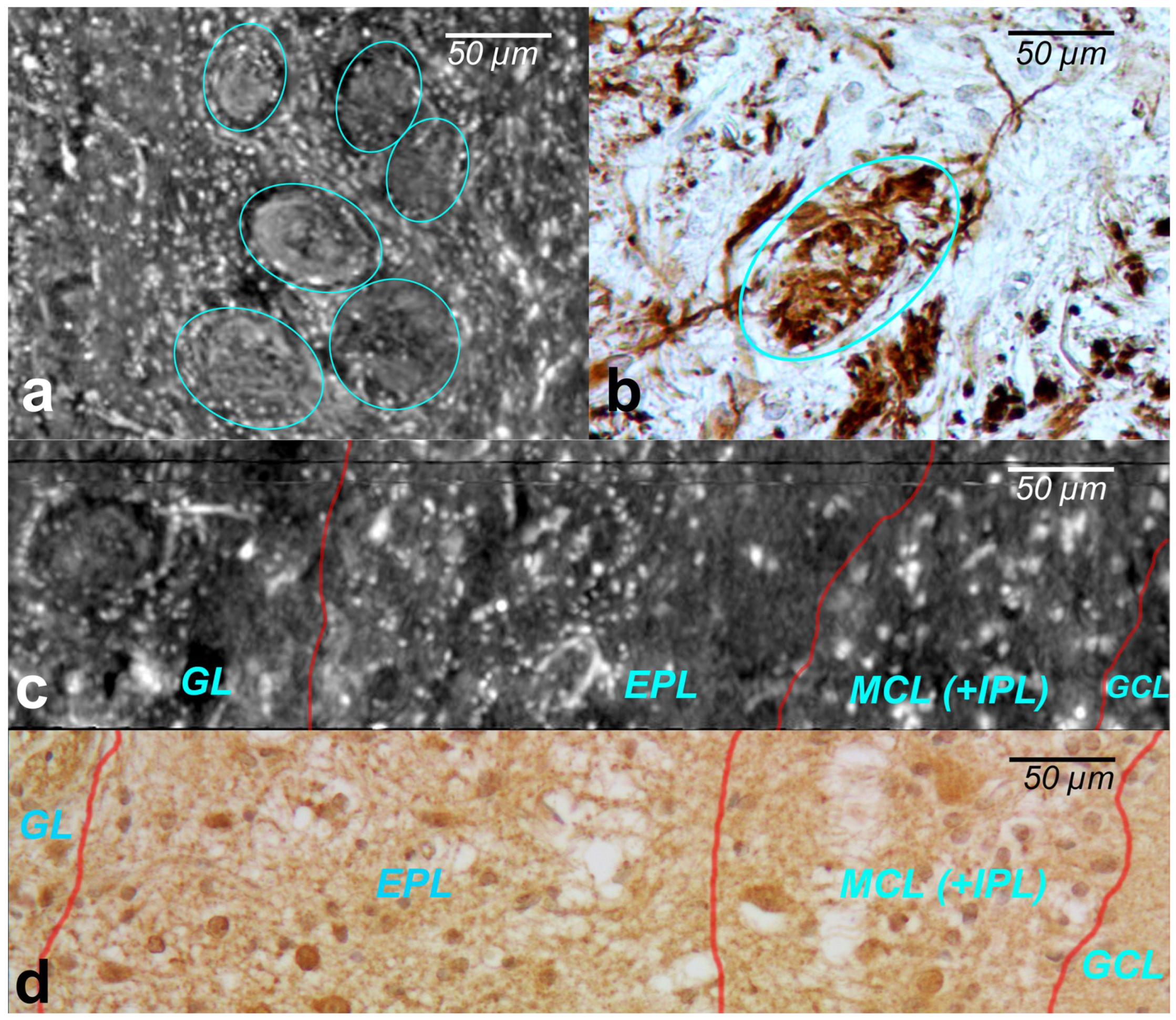 Tomography 08 00156 g003 Tomography 08 00156 g003