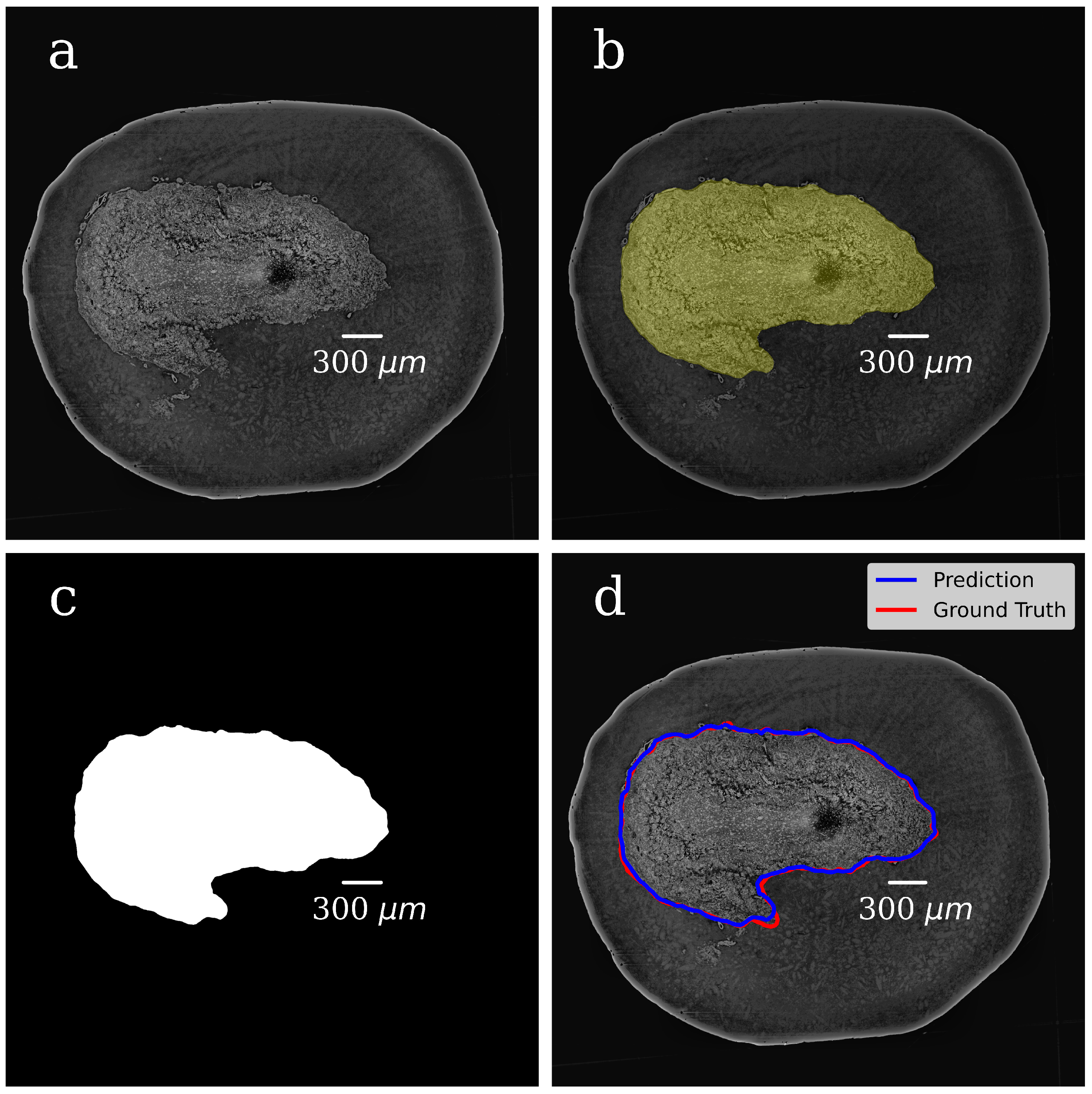 Tomography 08 00156 g004 Tomography 08 00156 g004
