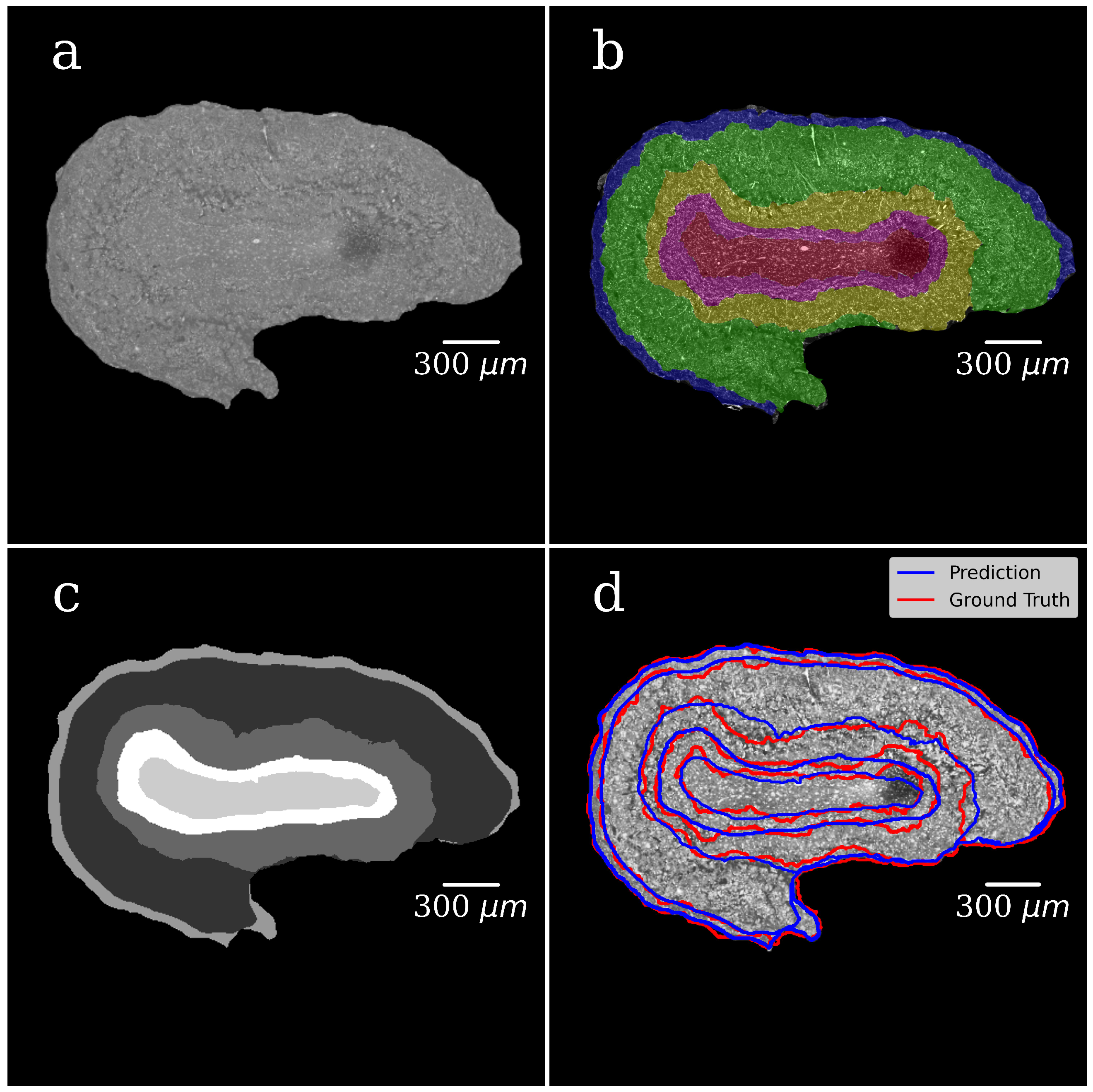 Tomography 08 00156 g005 Tomography 08 00156 g005