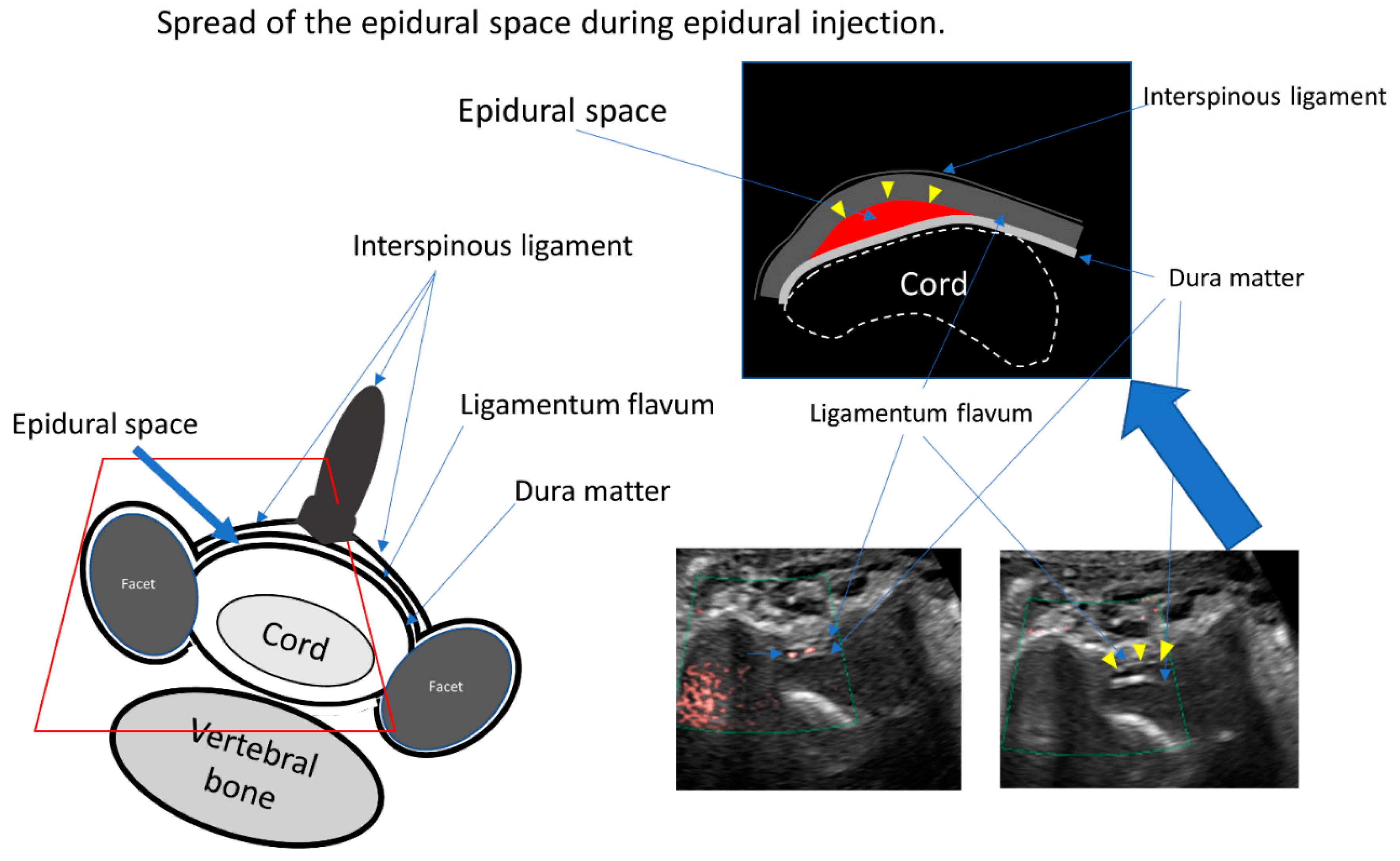 Tomography 08 00157 g004