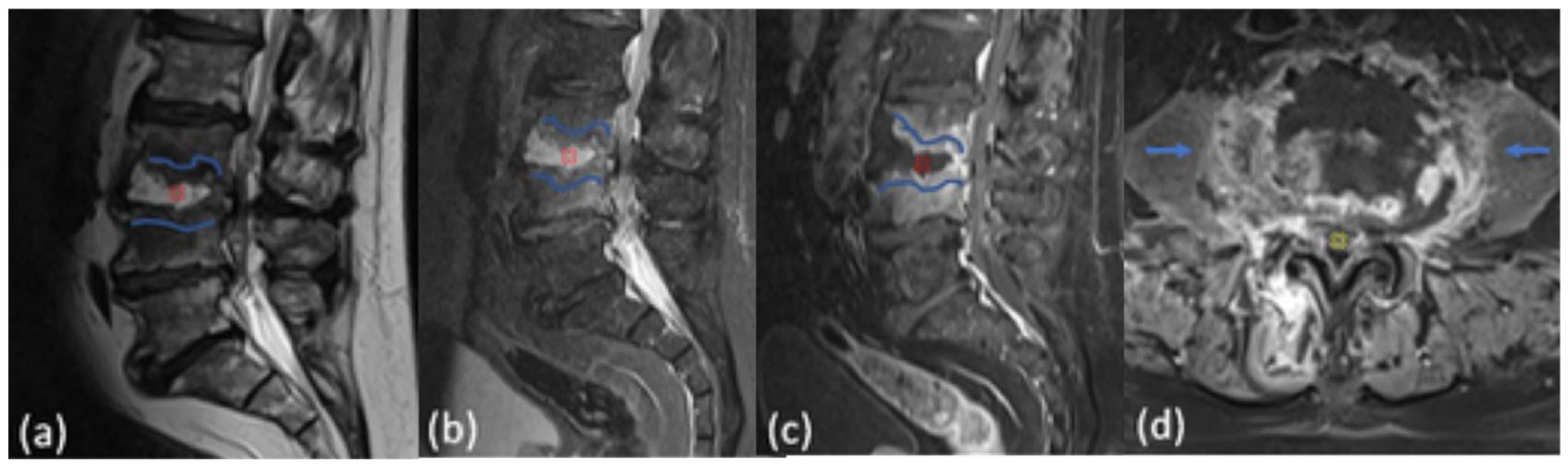 Tomography 08 00160 g002