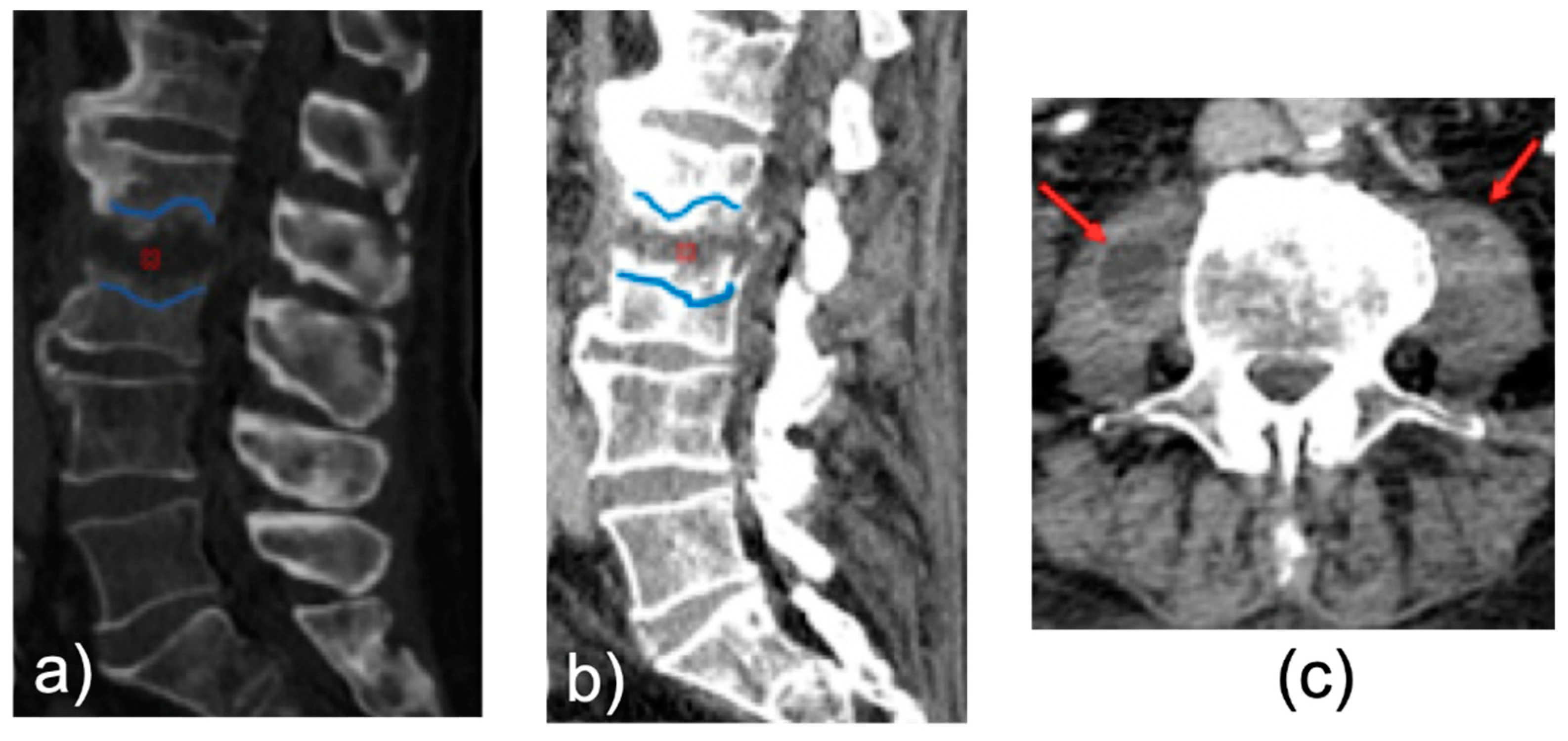 Tomography 08 00160 g003