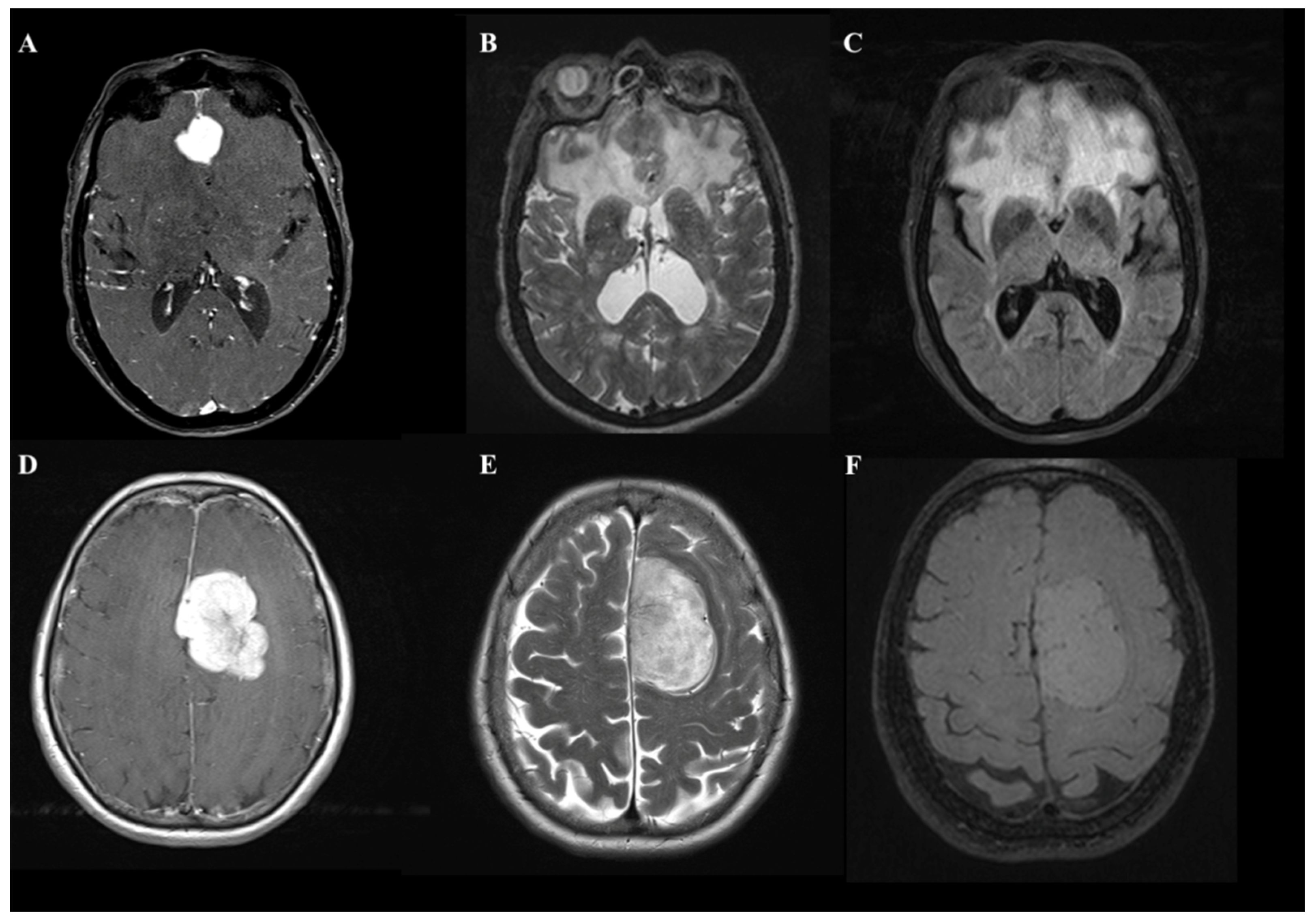 Tomography 08 00166 g001