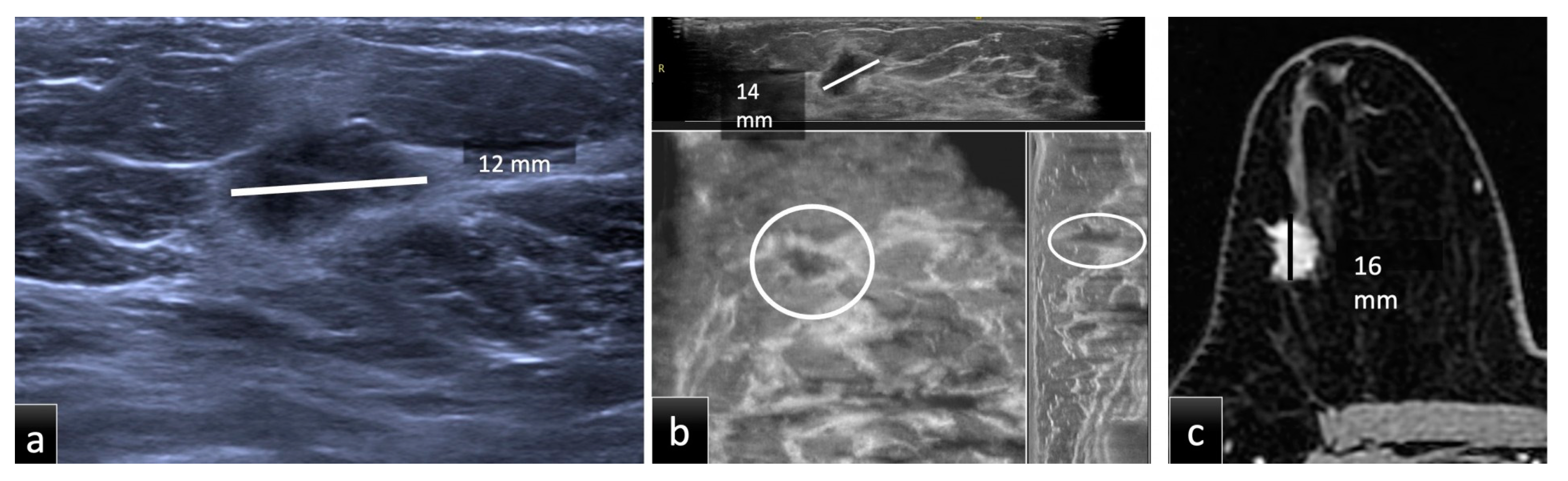 Tomography 08 00167 g001