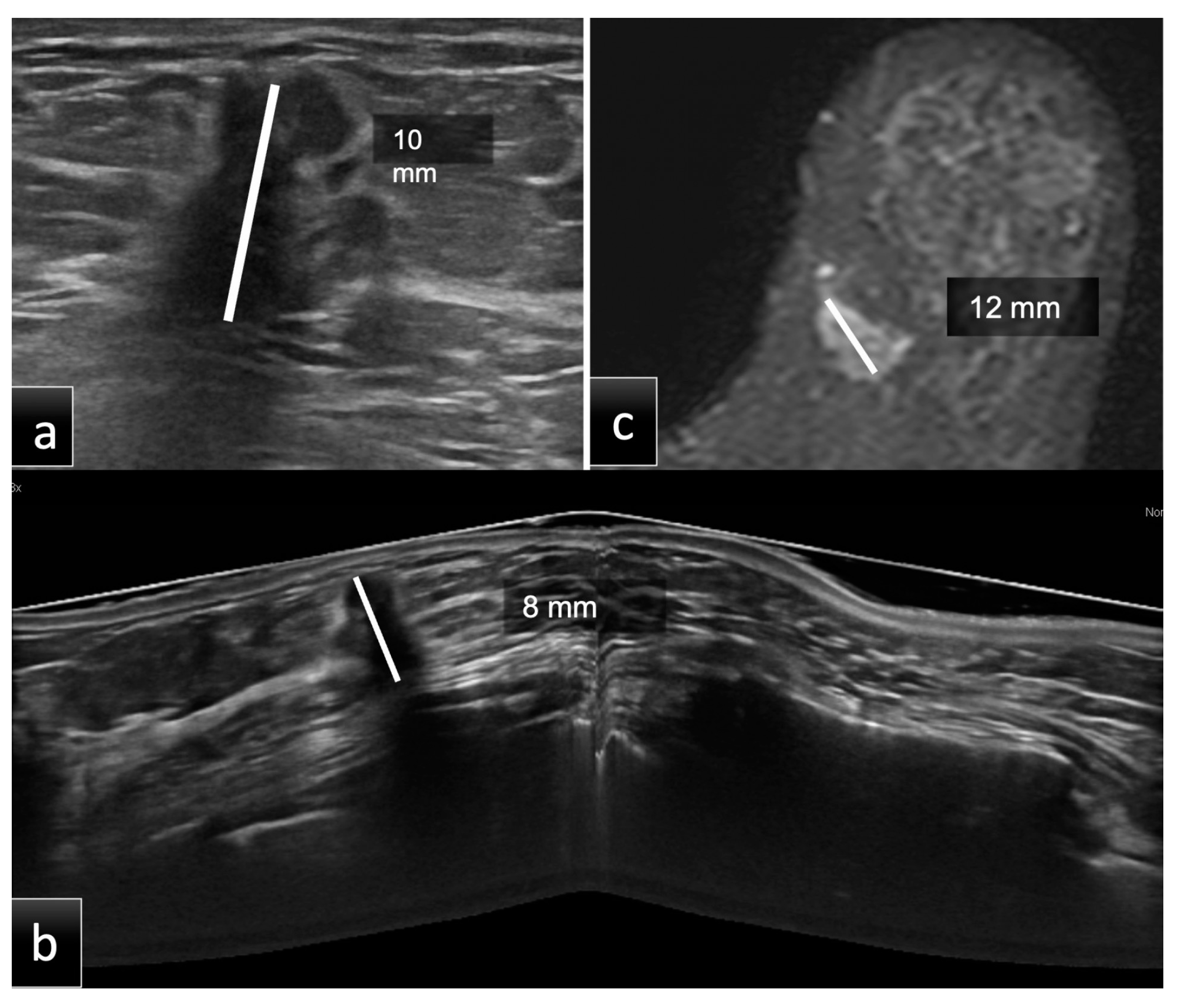 Tomography 08 00167 g002