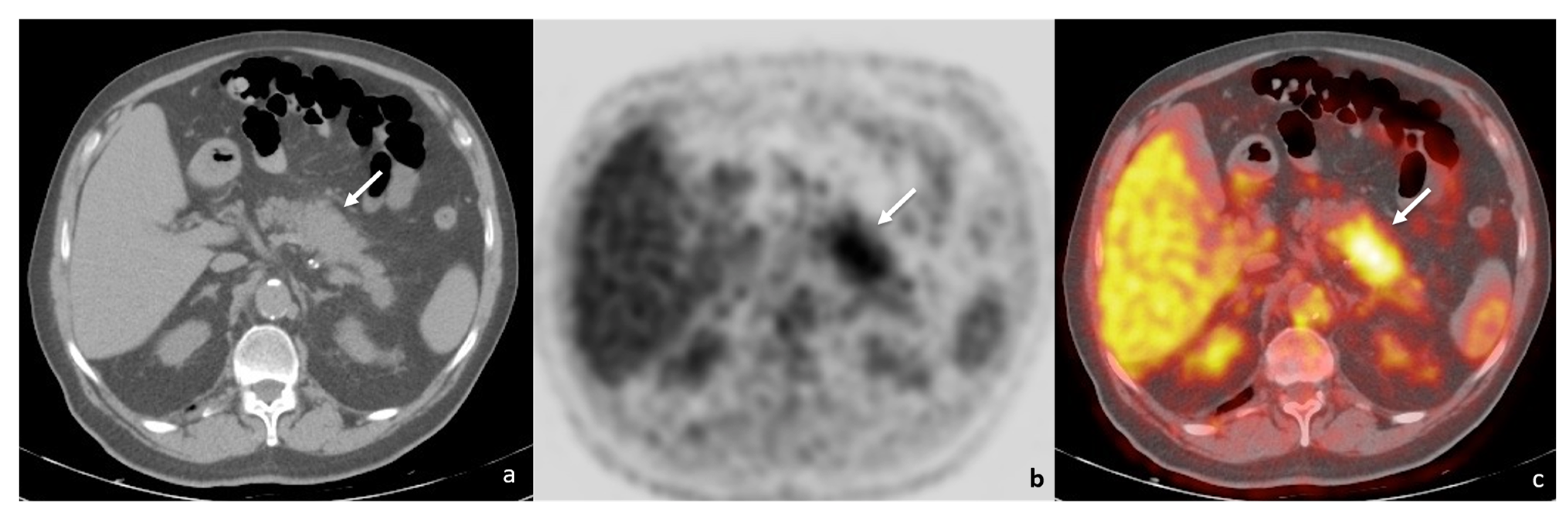 Tomography 08 00174 g001