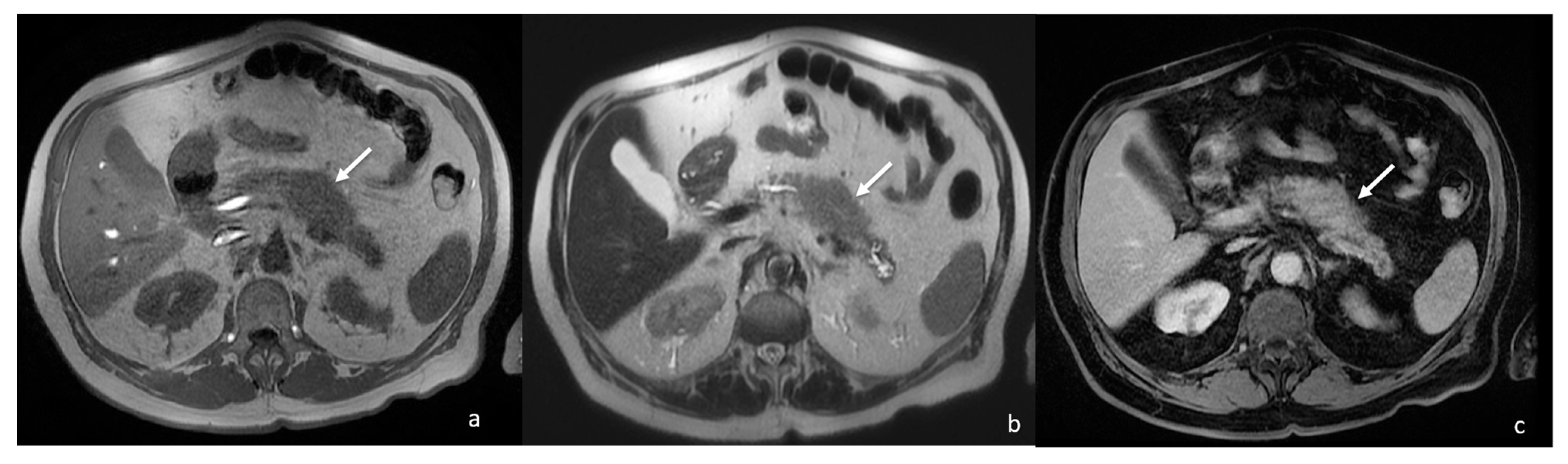 Tomography 08 00174 g002
