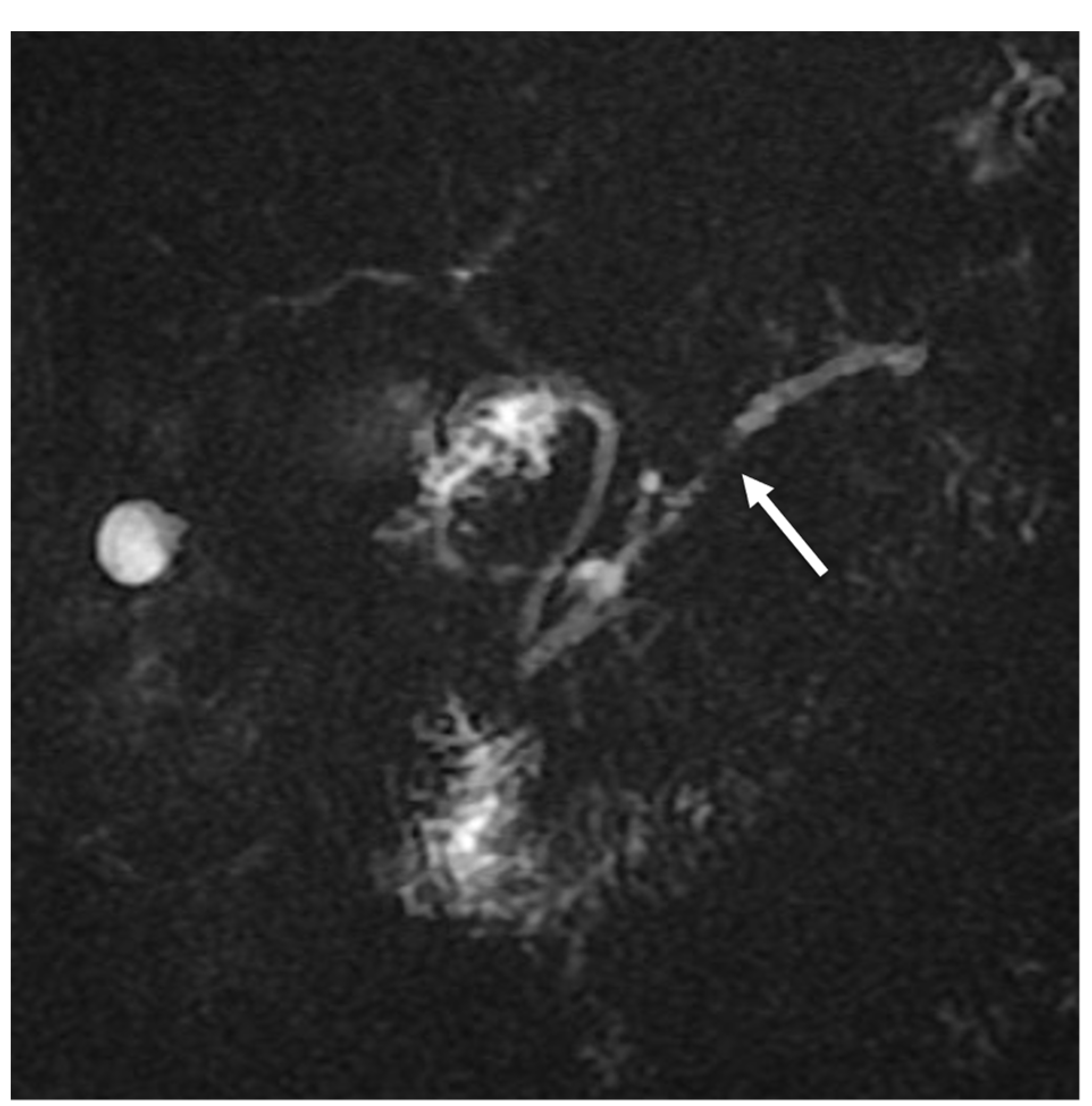 Tomography 08 00174 g003