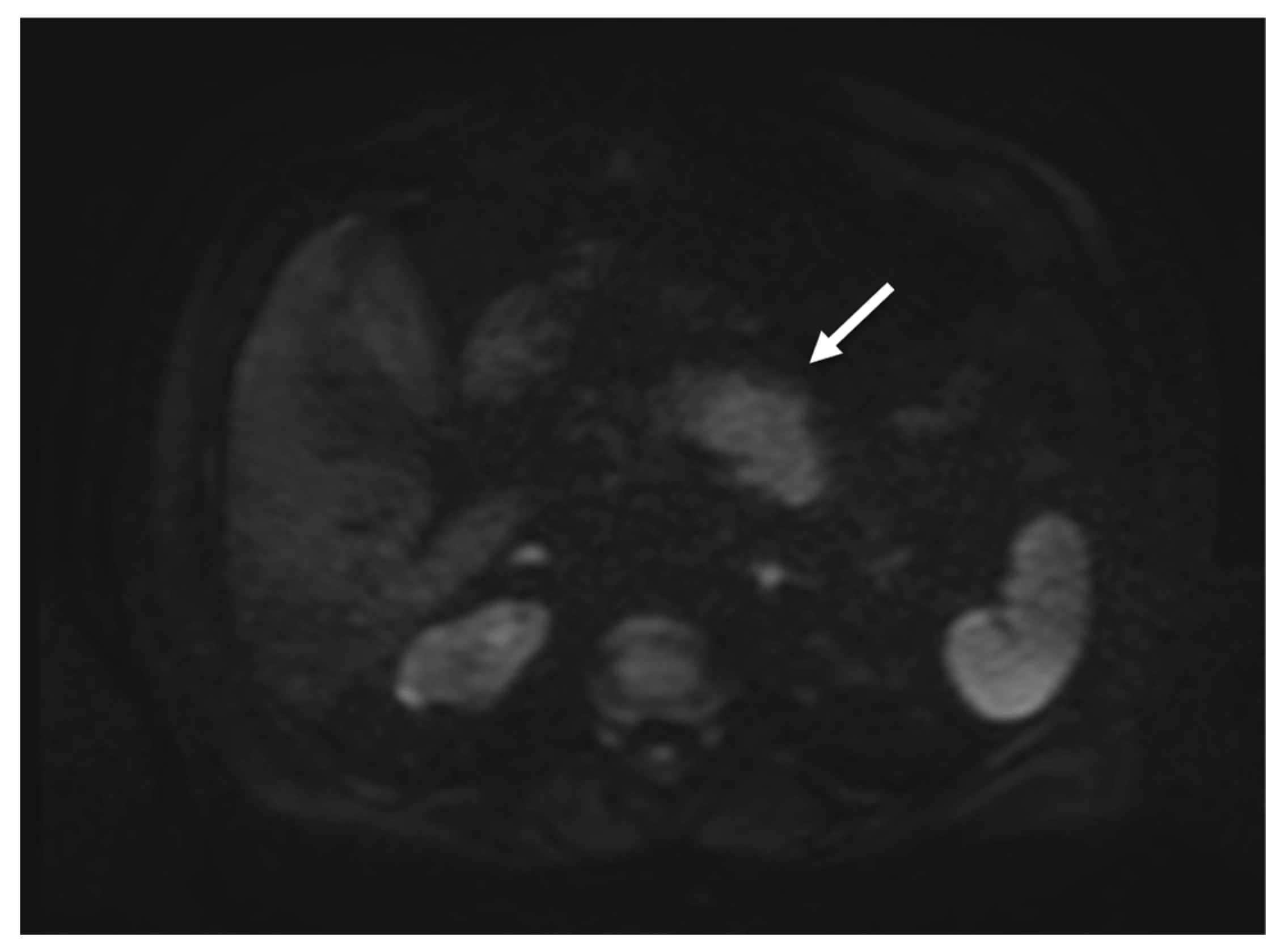 Tomography 08 00174 g004