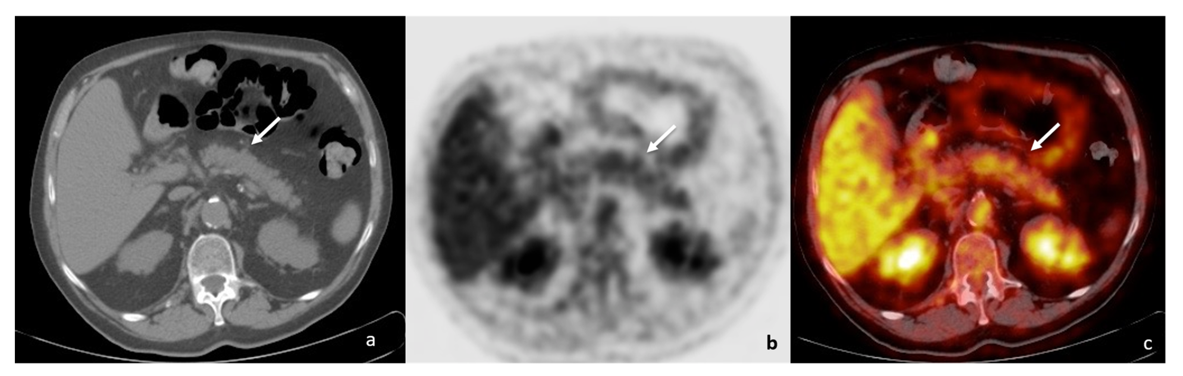 Tomography 08 00174 g008