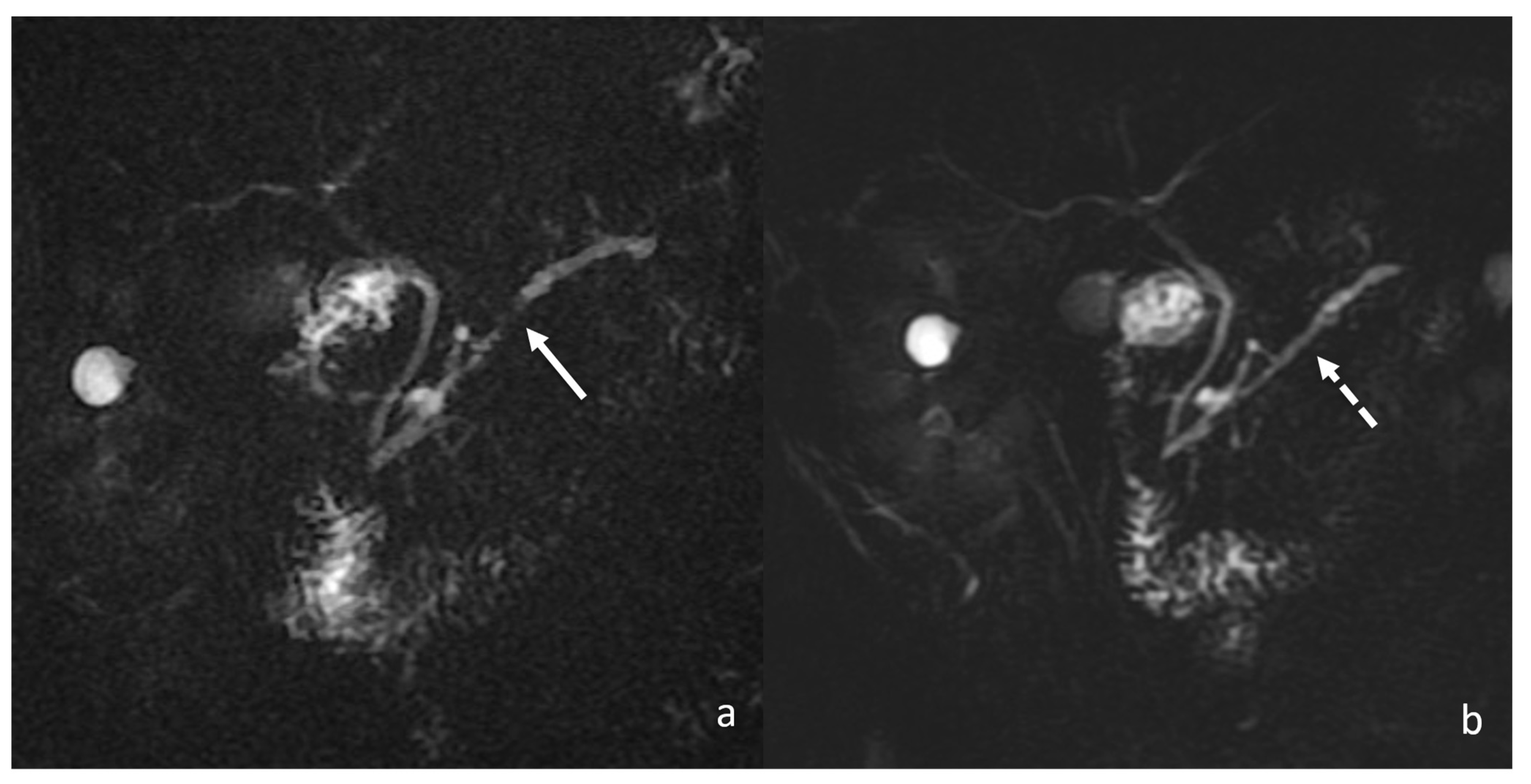 Tomography 08 00174 g009