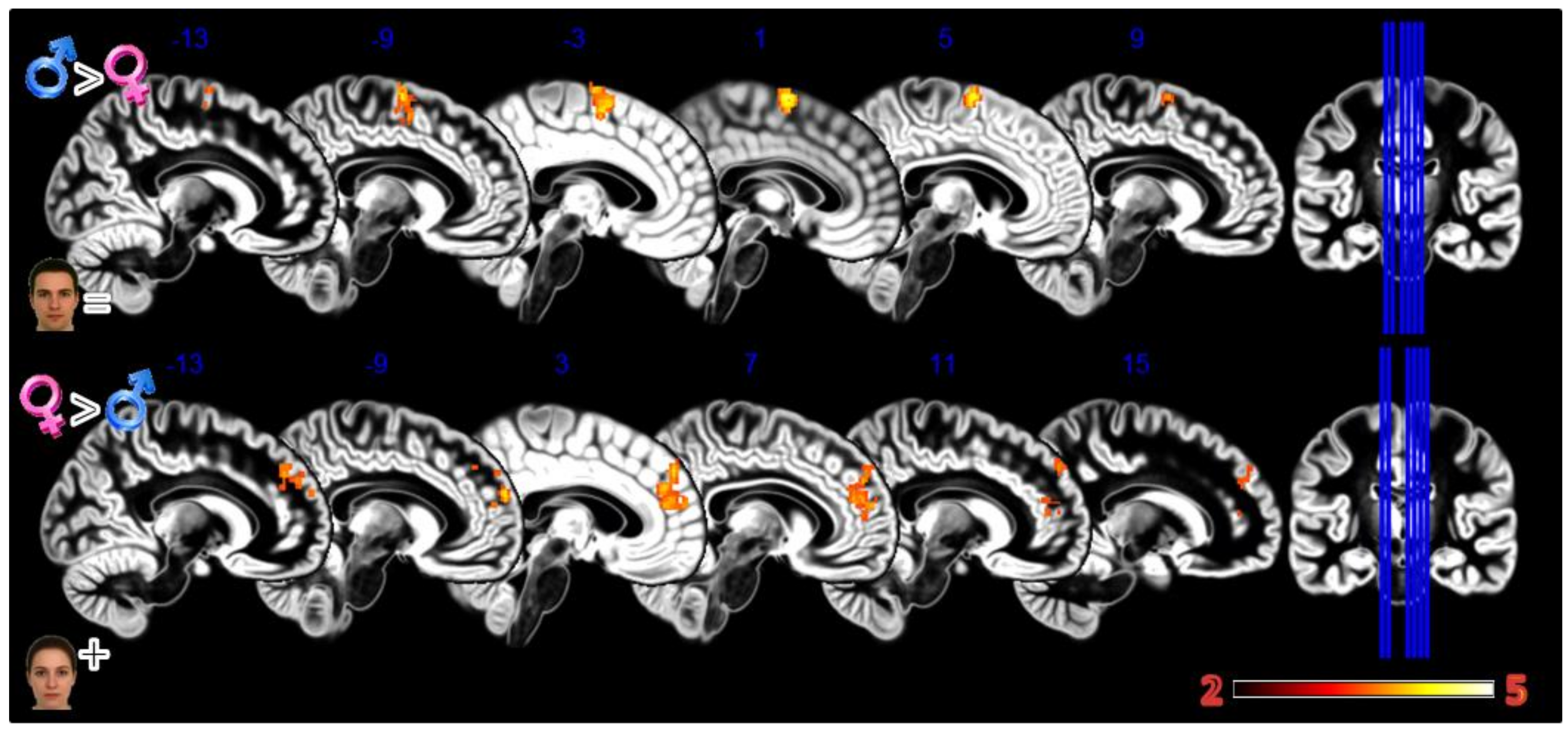 Tomography 08 00176 g004 Tomography 08 00176 g004