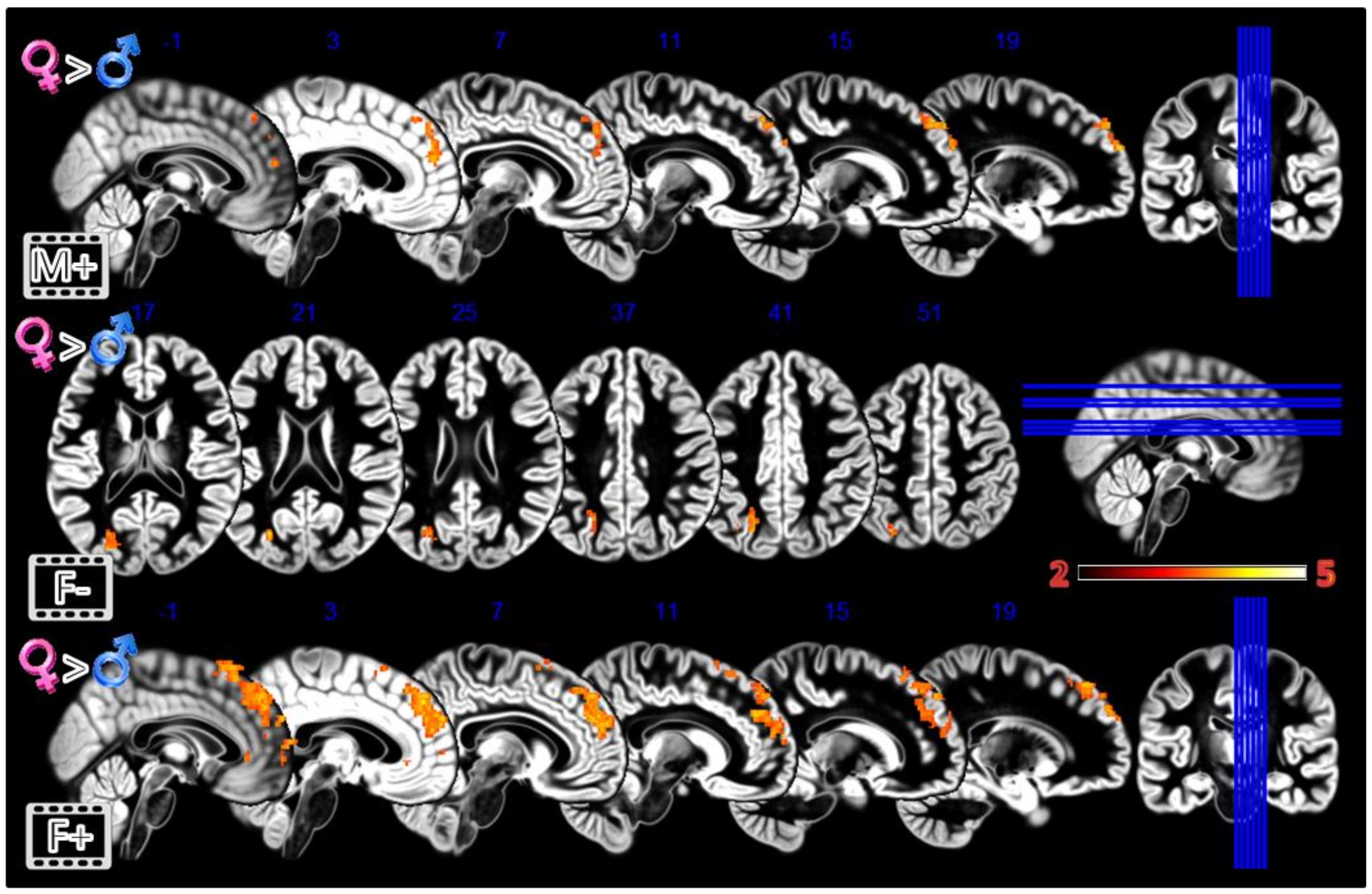 Tomography 08 00176 g005 Tomography 08 00176 g005