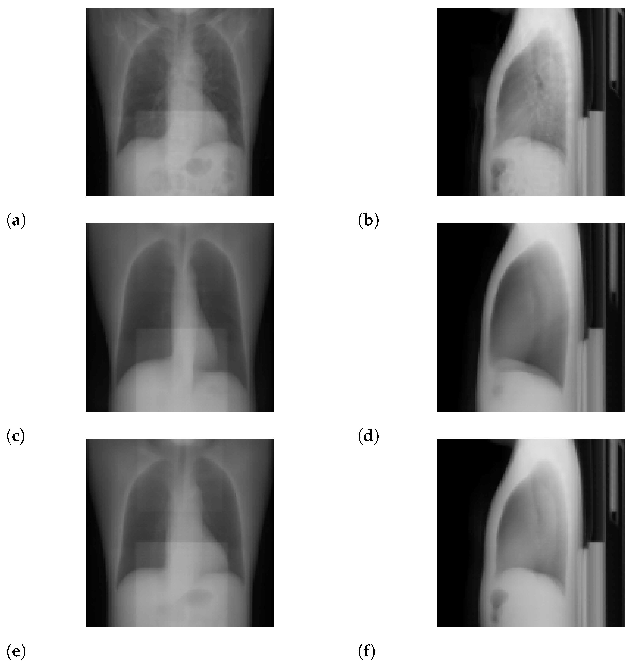 Tomography 08 00179 g003