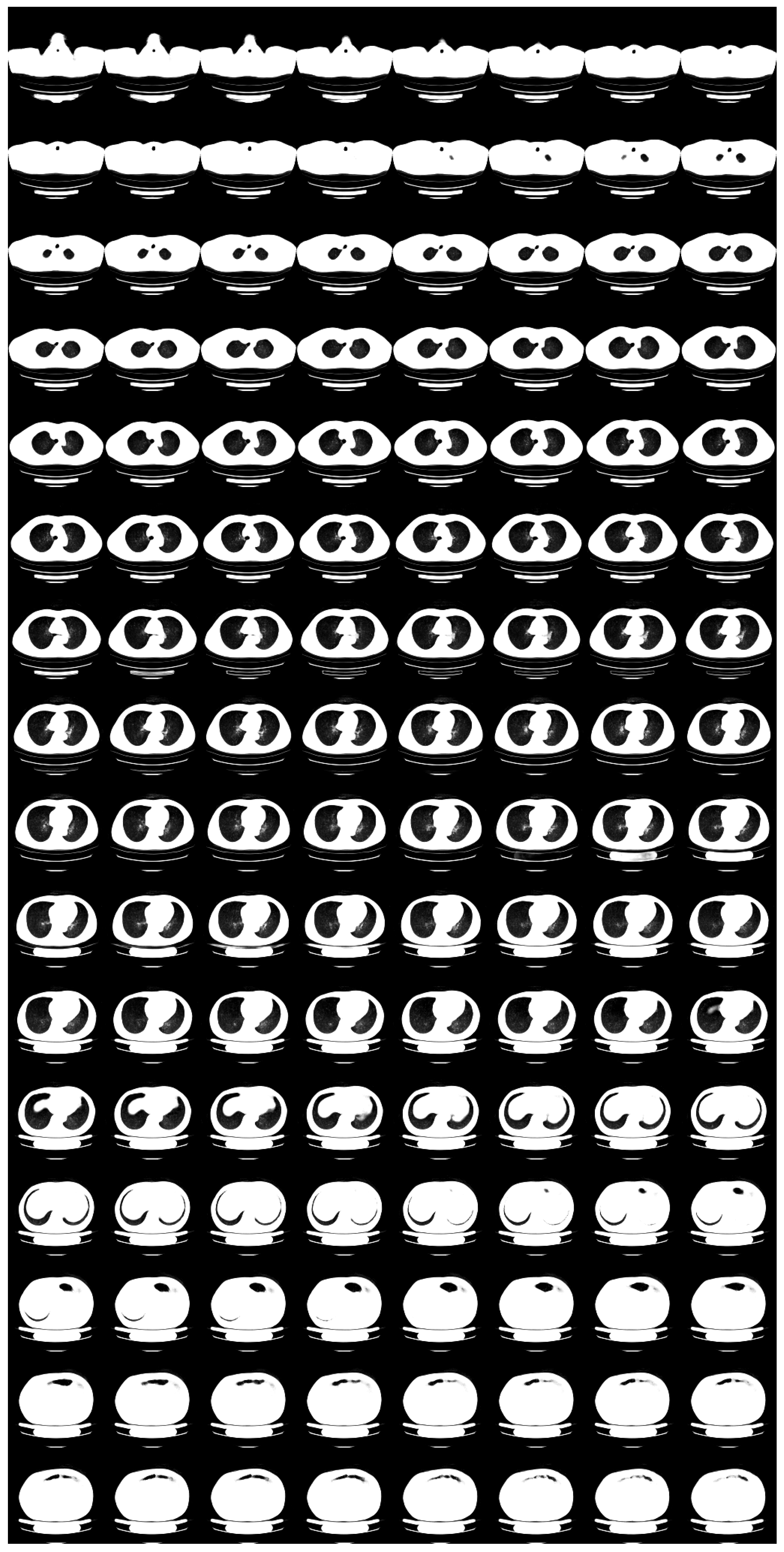 Tomography 08 00179 g004