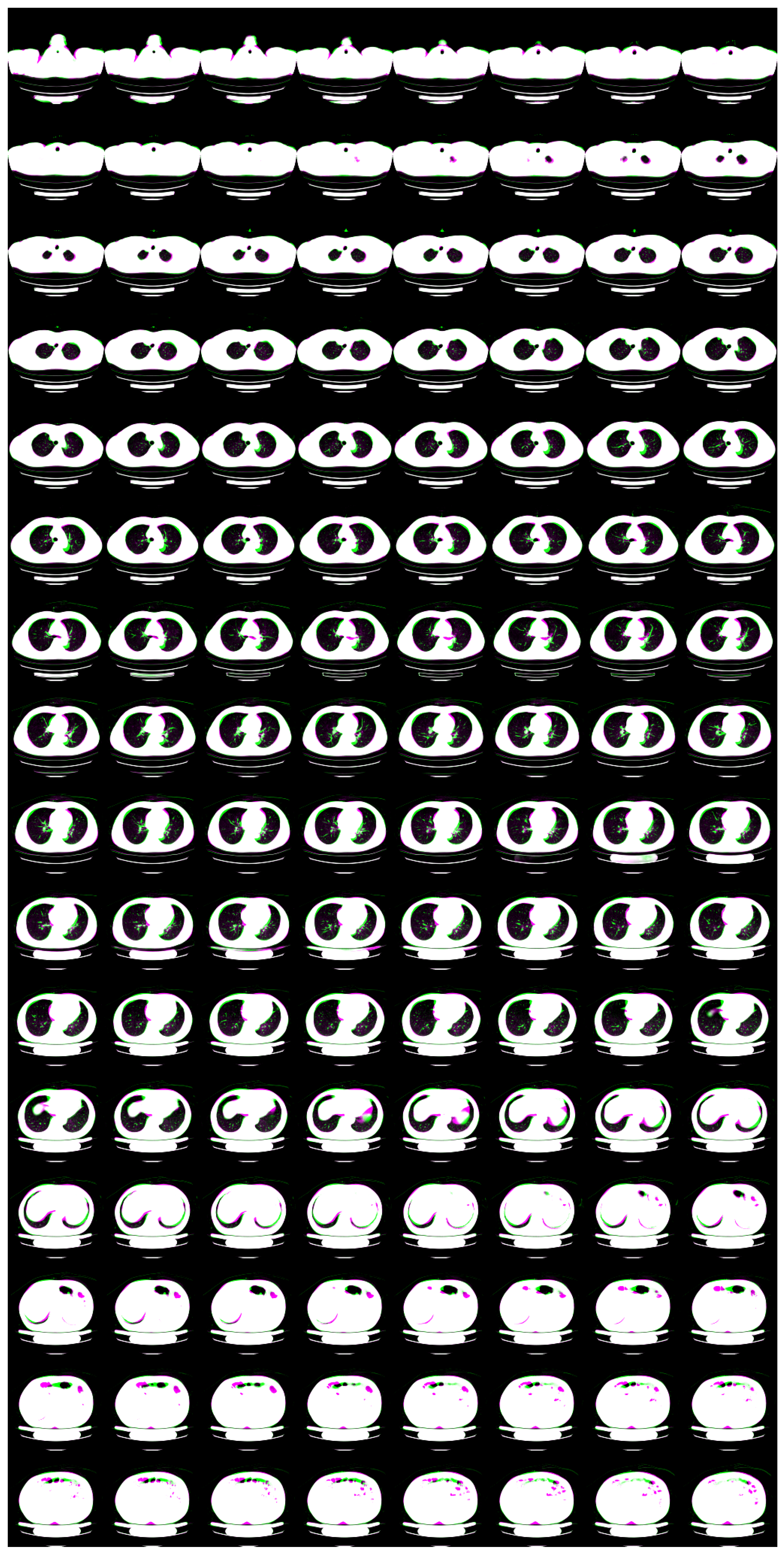 Tomography 08 00179 g005