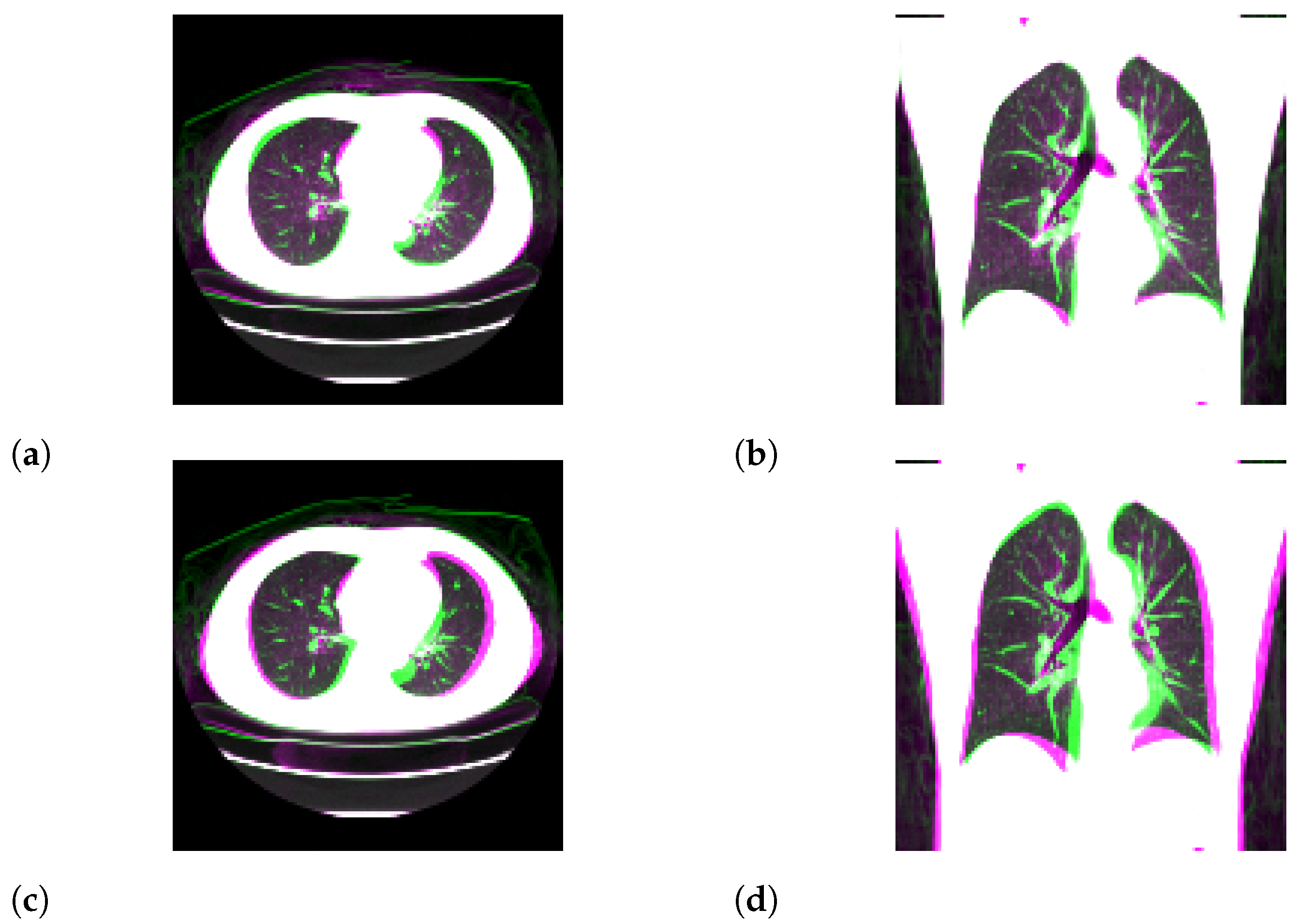 Tomography 08 00179 g006