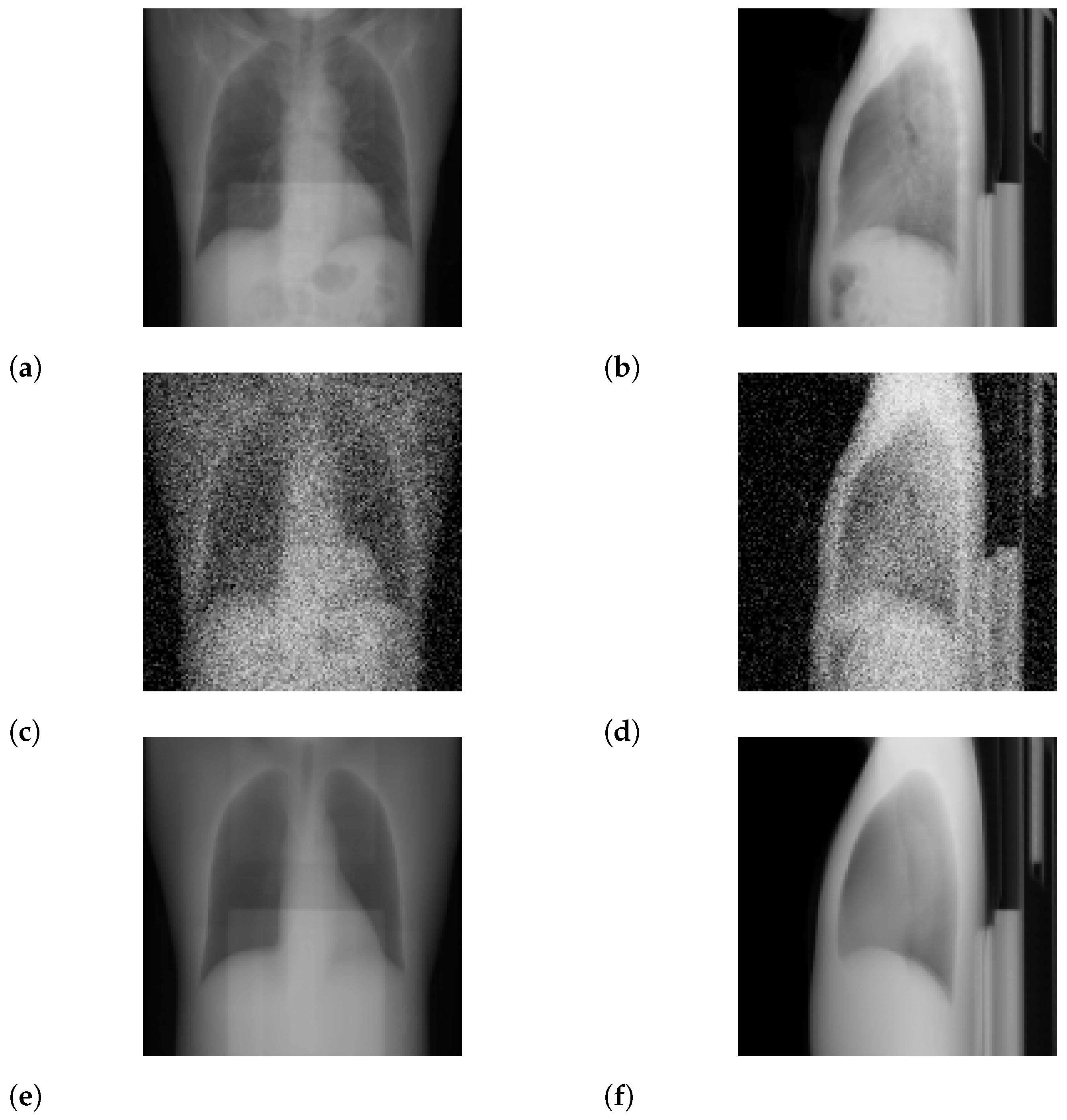 Tomography 08 00179 g007