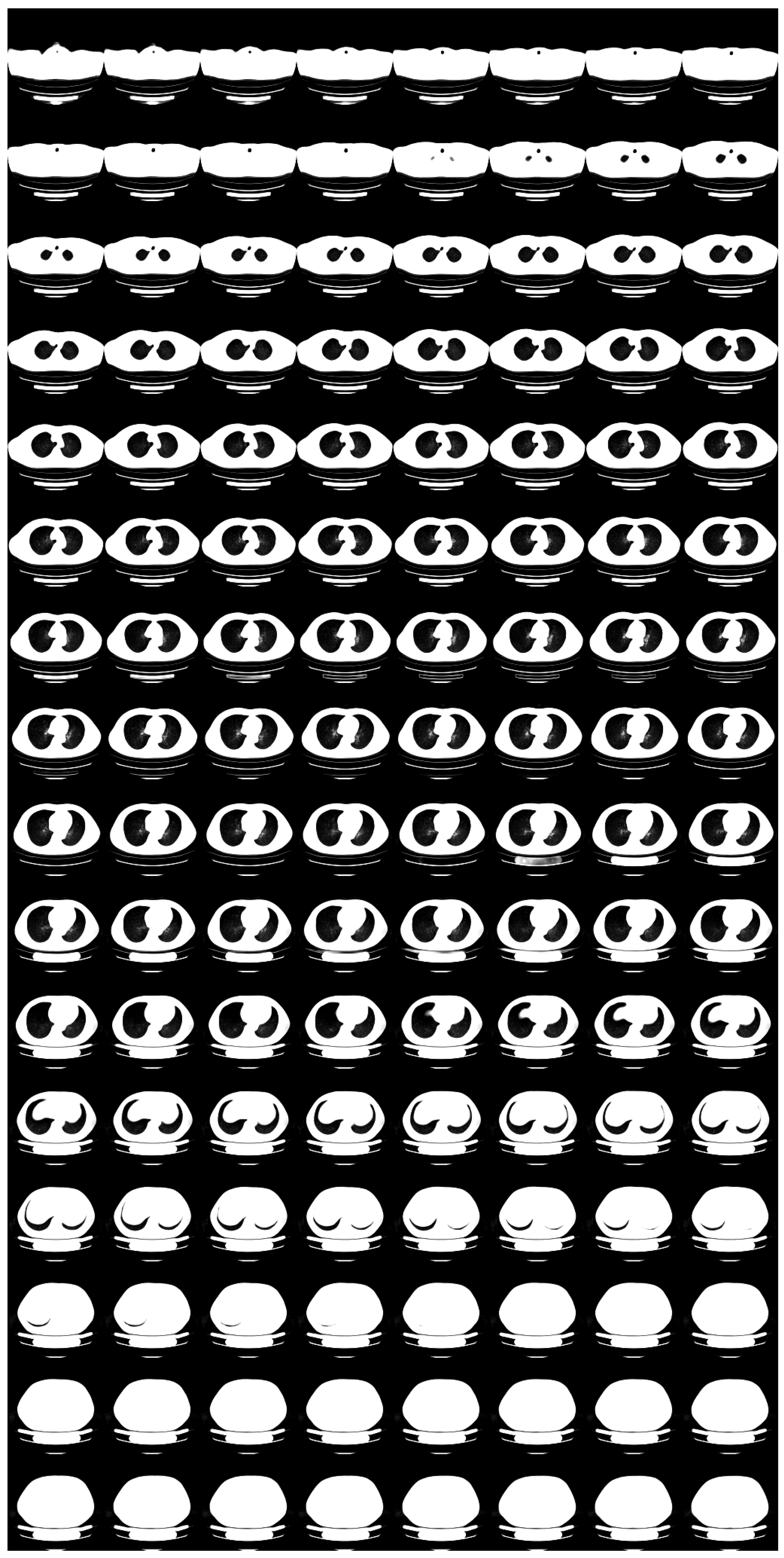 Tomography 08 00179 g008