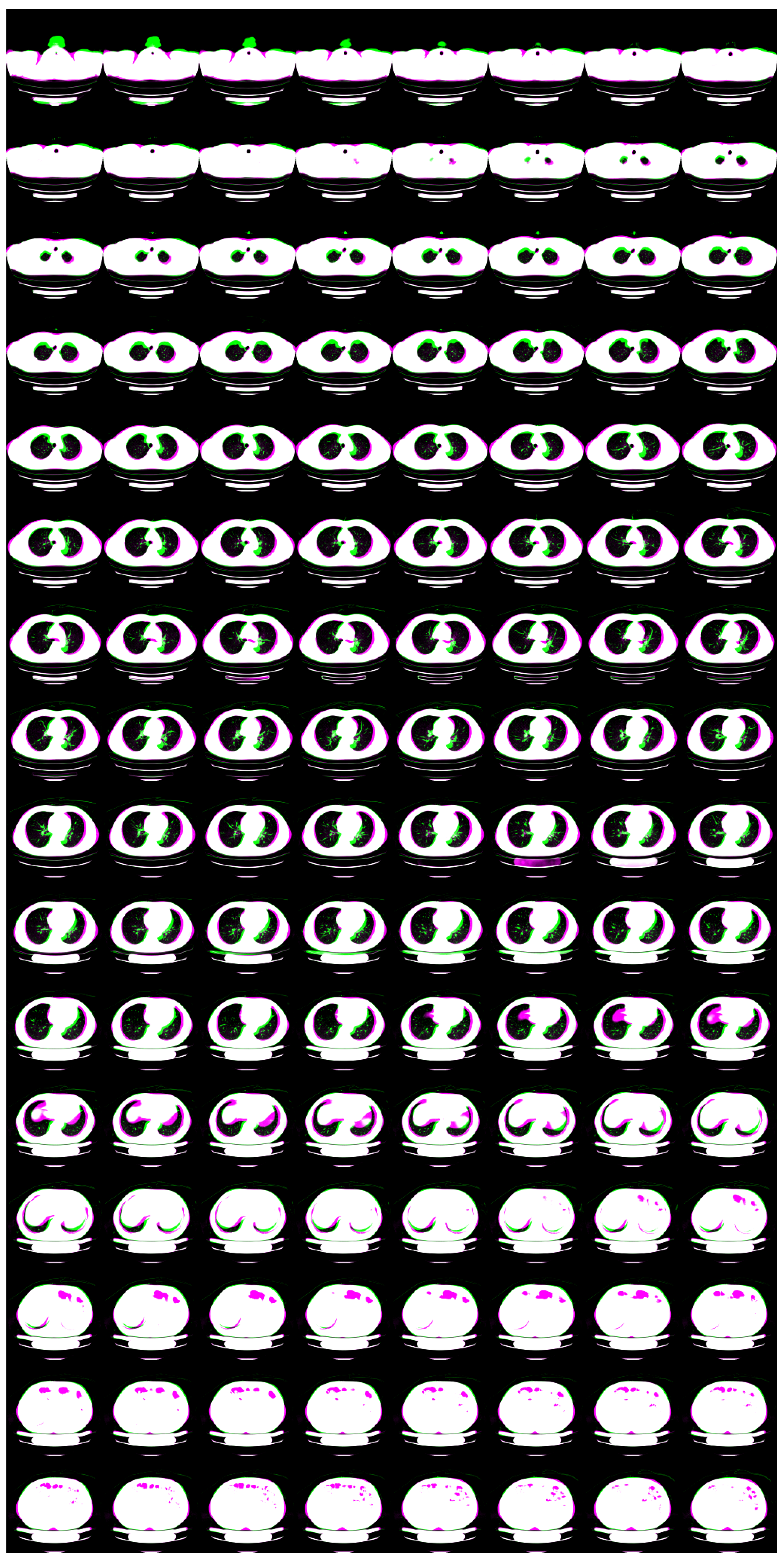 Tomography 08 00179 g009