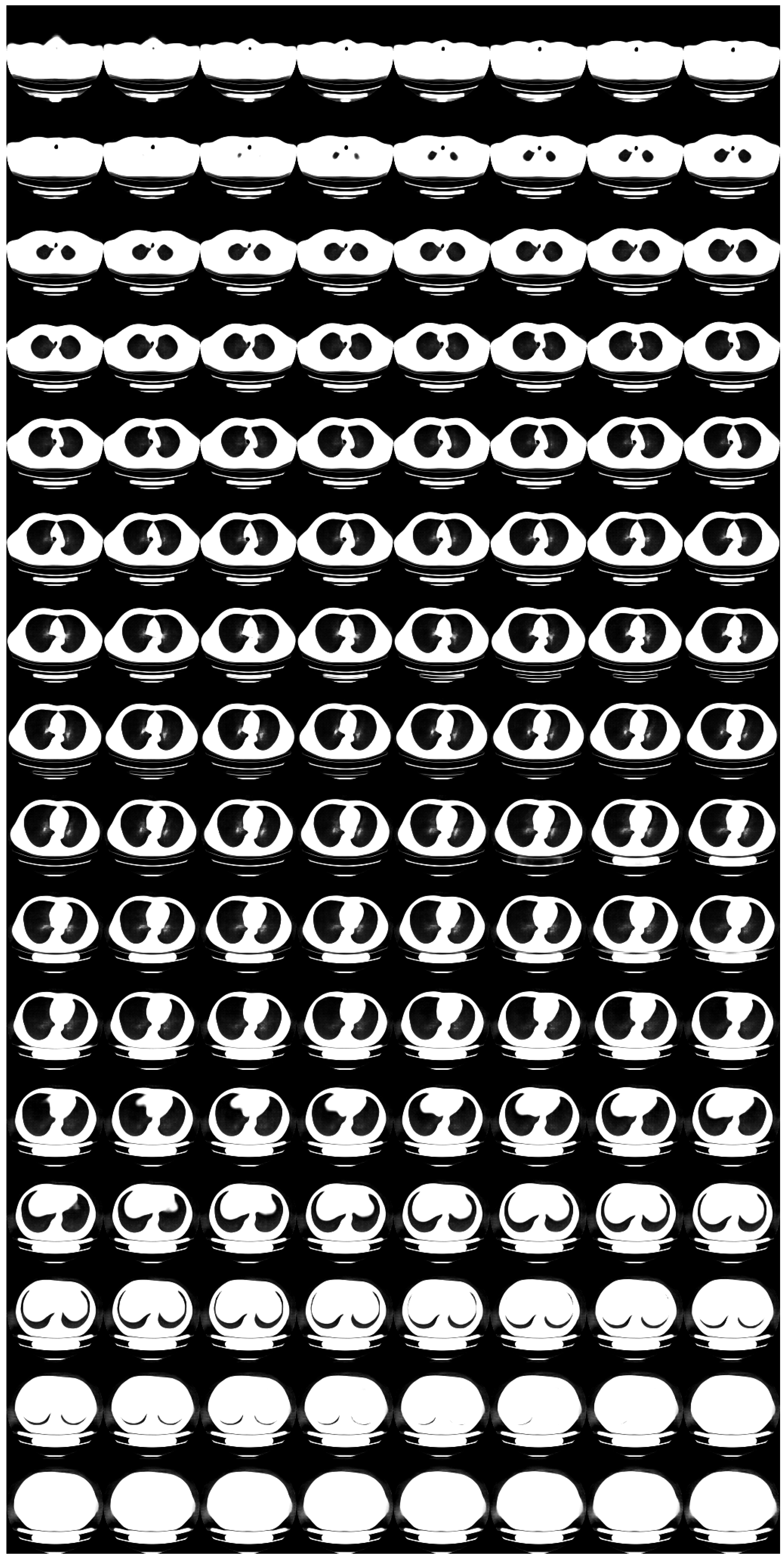 Tomography 08 00179 g0a2