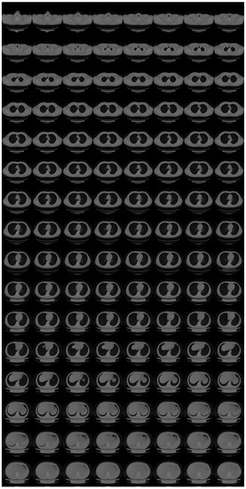 Tomography 08 00179 g0a3 550