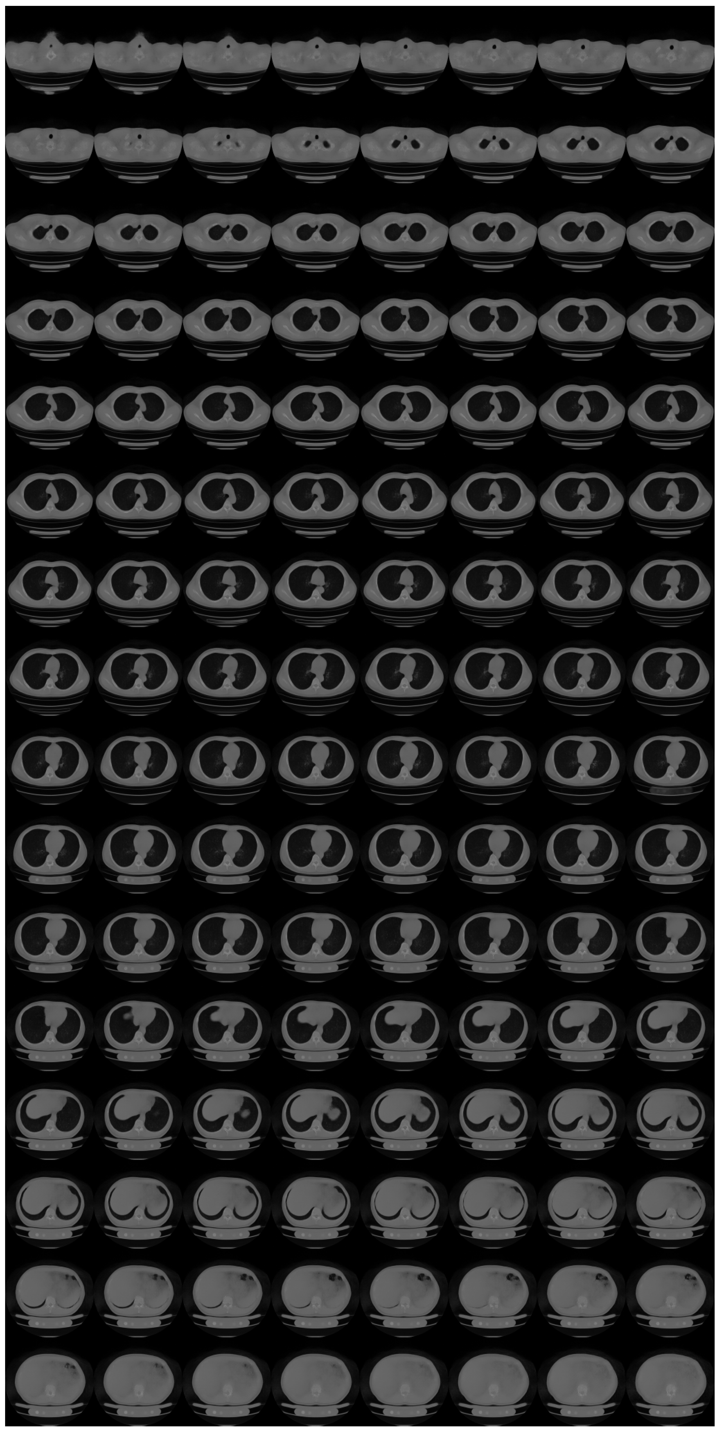 Tomography 08 00179 g0a3