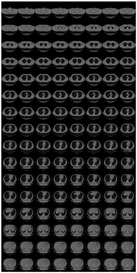 Tomography 08 00179 g0a4 550