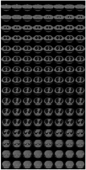 Tomography 08 00179 g0a5 550
