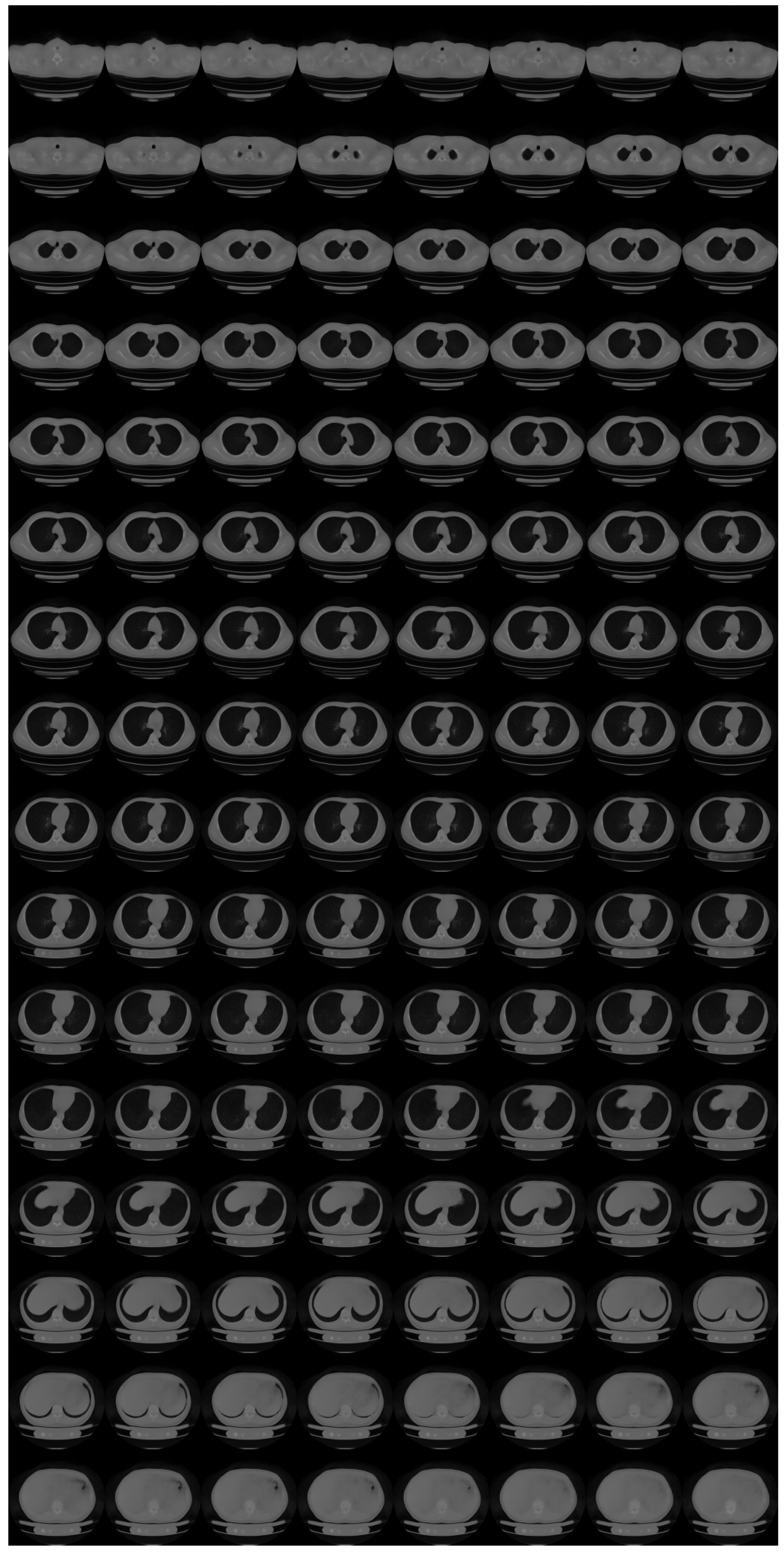 Tomography 08 00179 g0a5