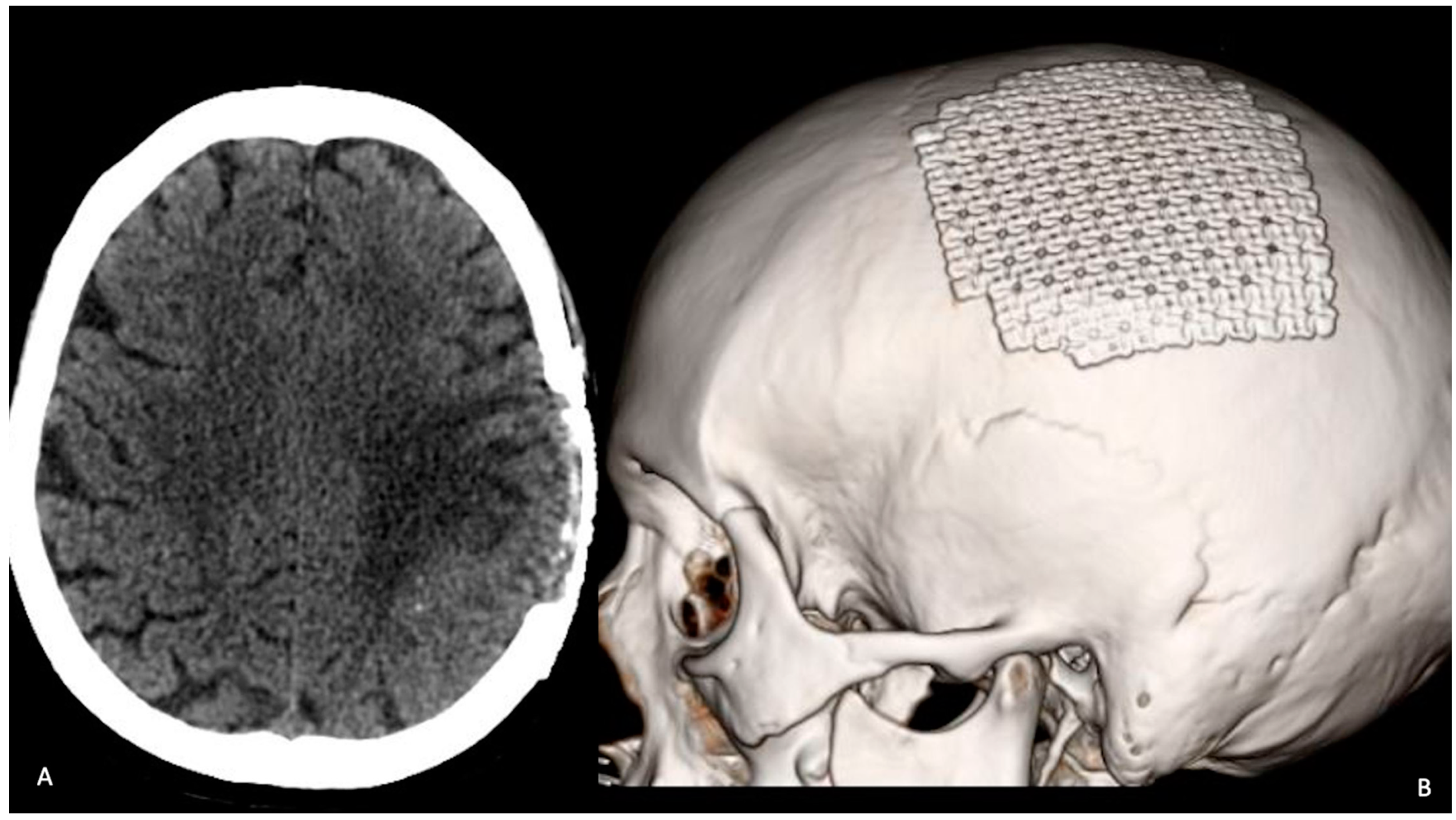 Tomography 08 00181 g004