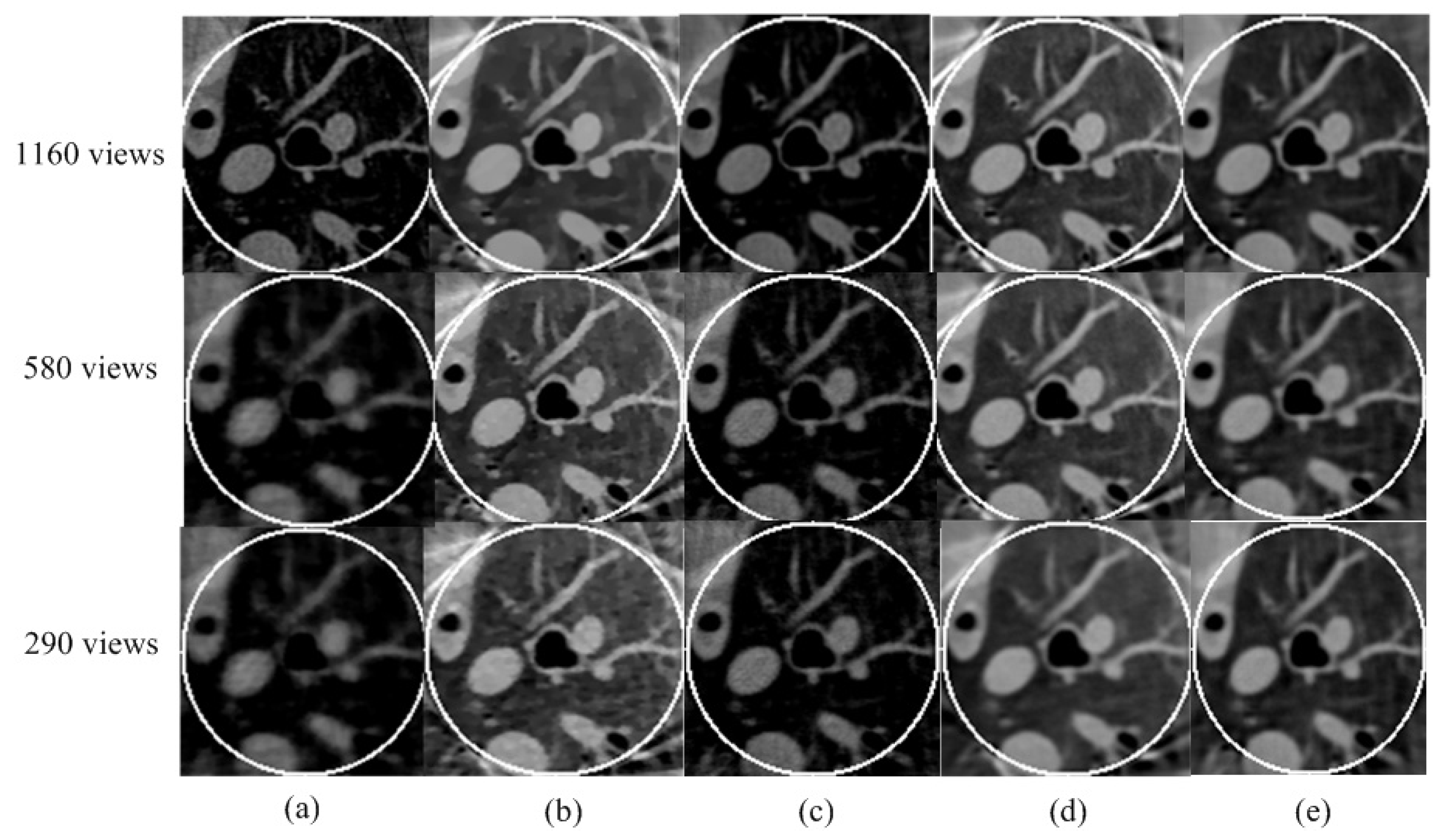 Tomography 08 00186 g006