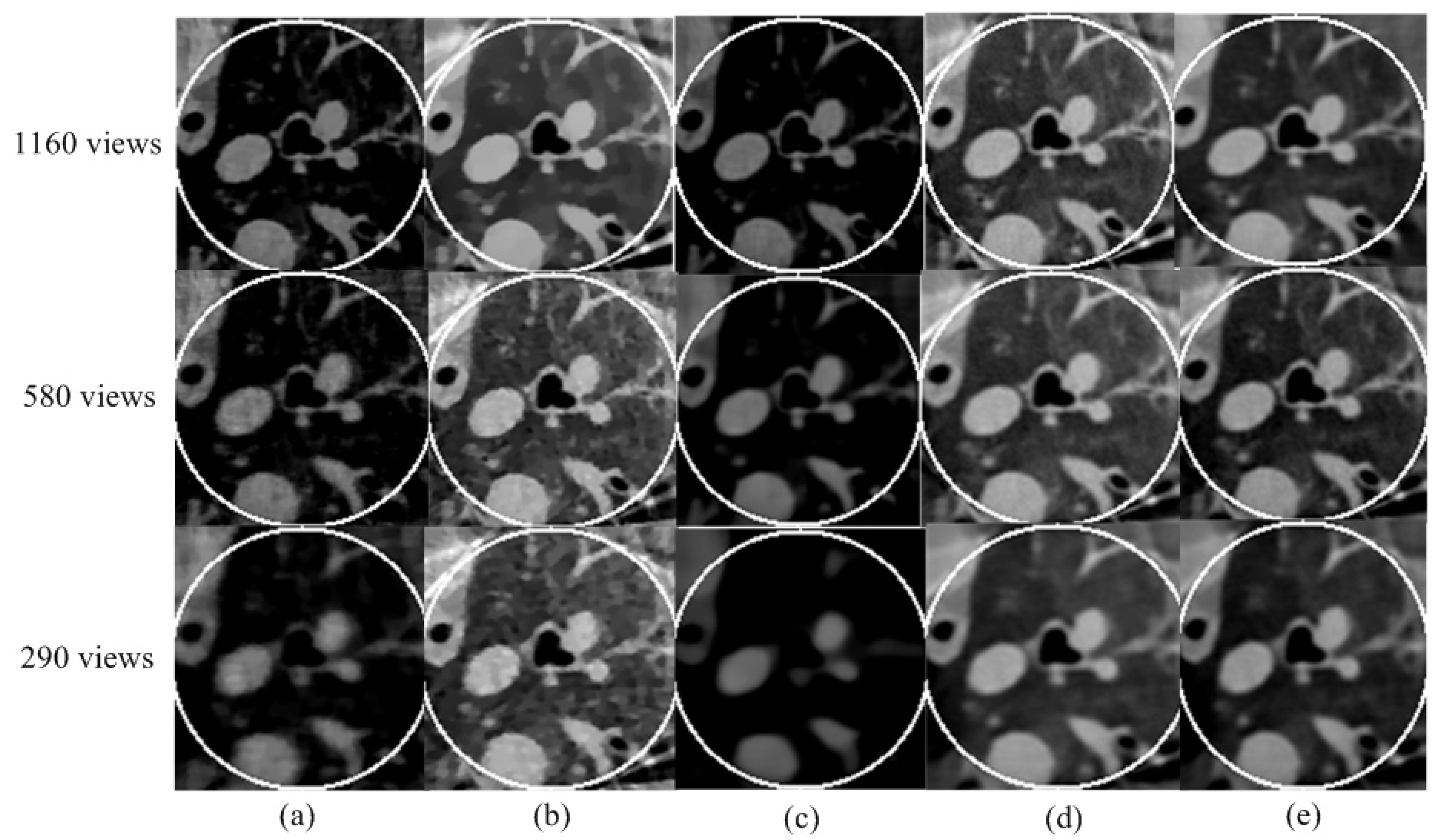 Tomography 08 00186 g008