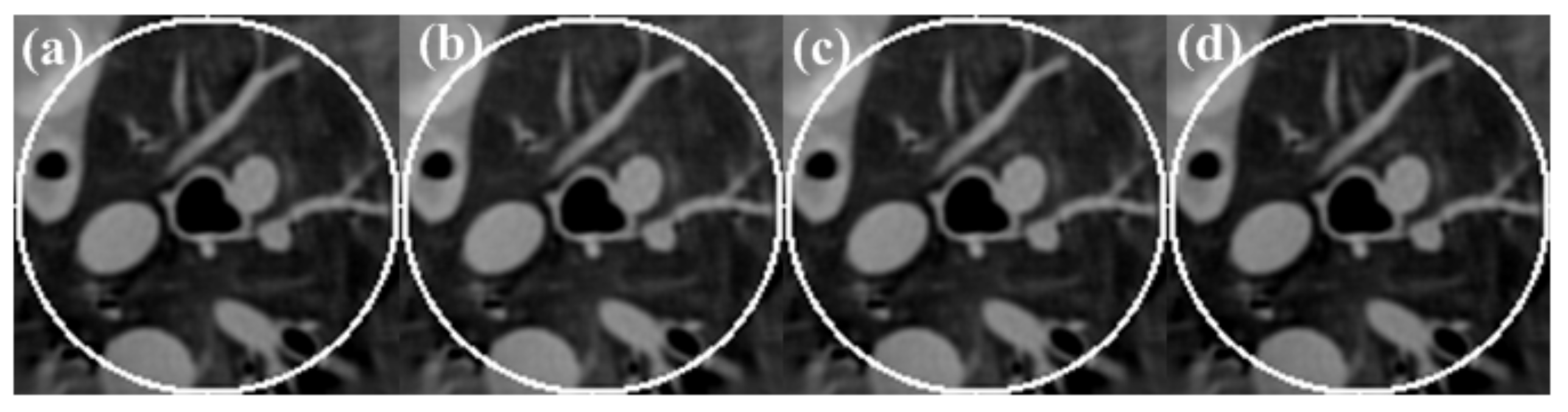 Tomography 08 00186 g010