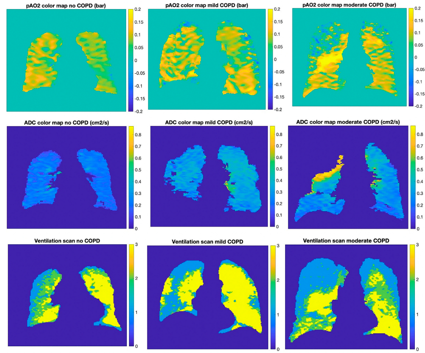 Tomography 08 00190 g002