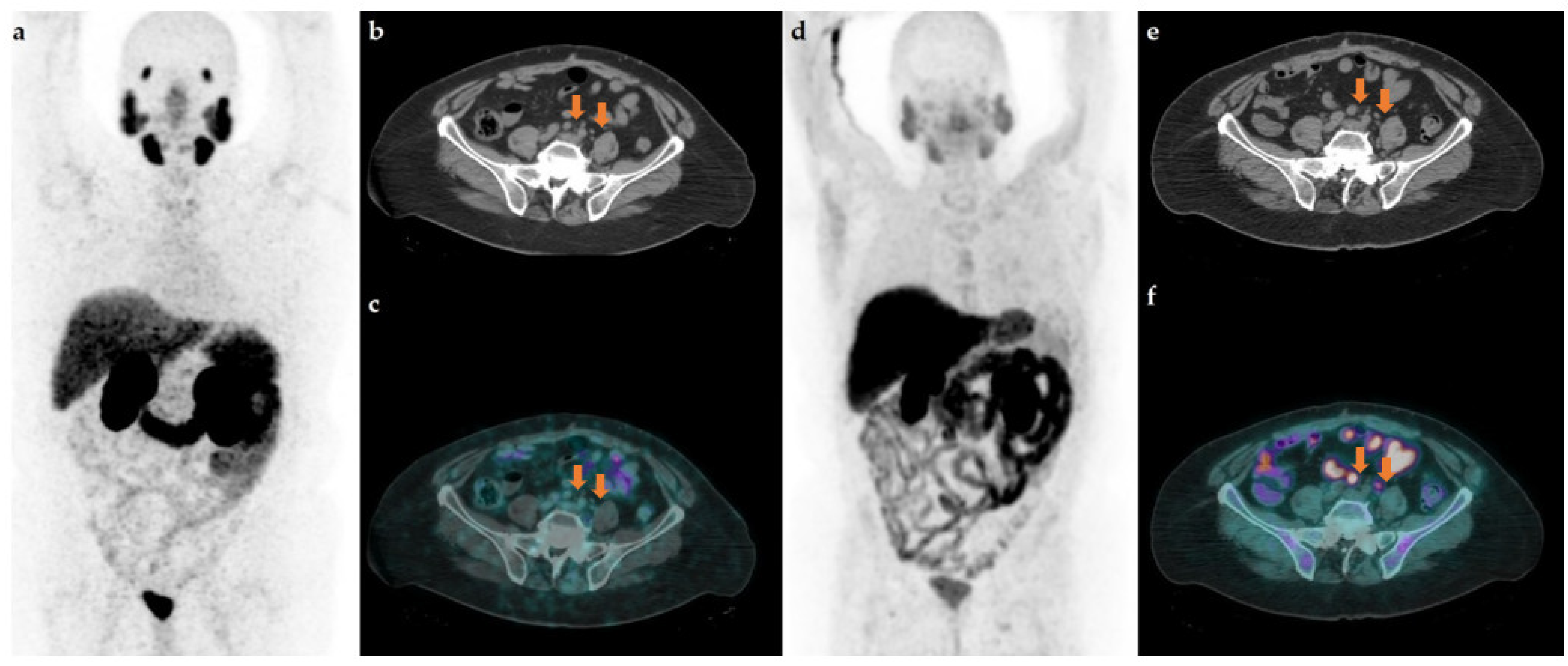 Tomography 08 00205 g001