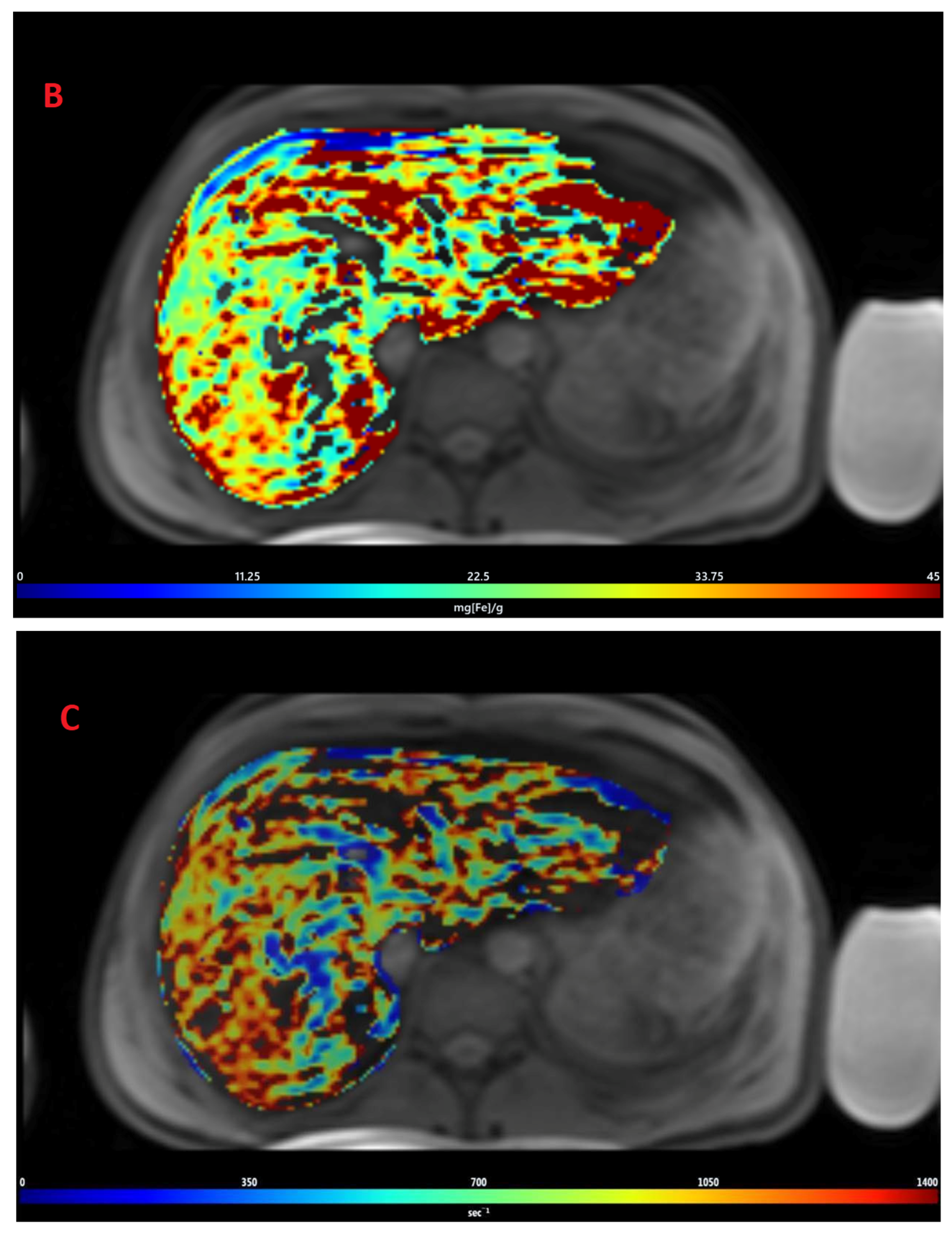 Tomography 08 00209 g002b Tomography 08 00209 g002b