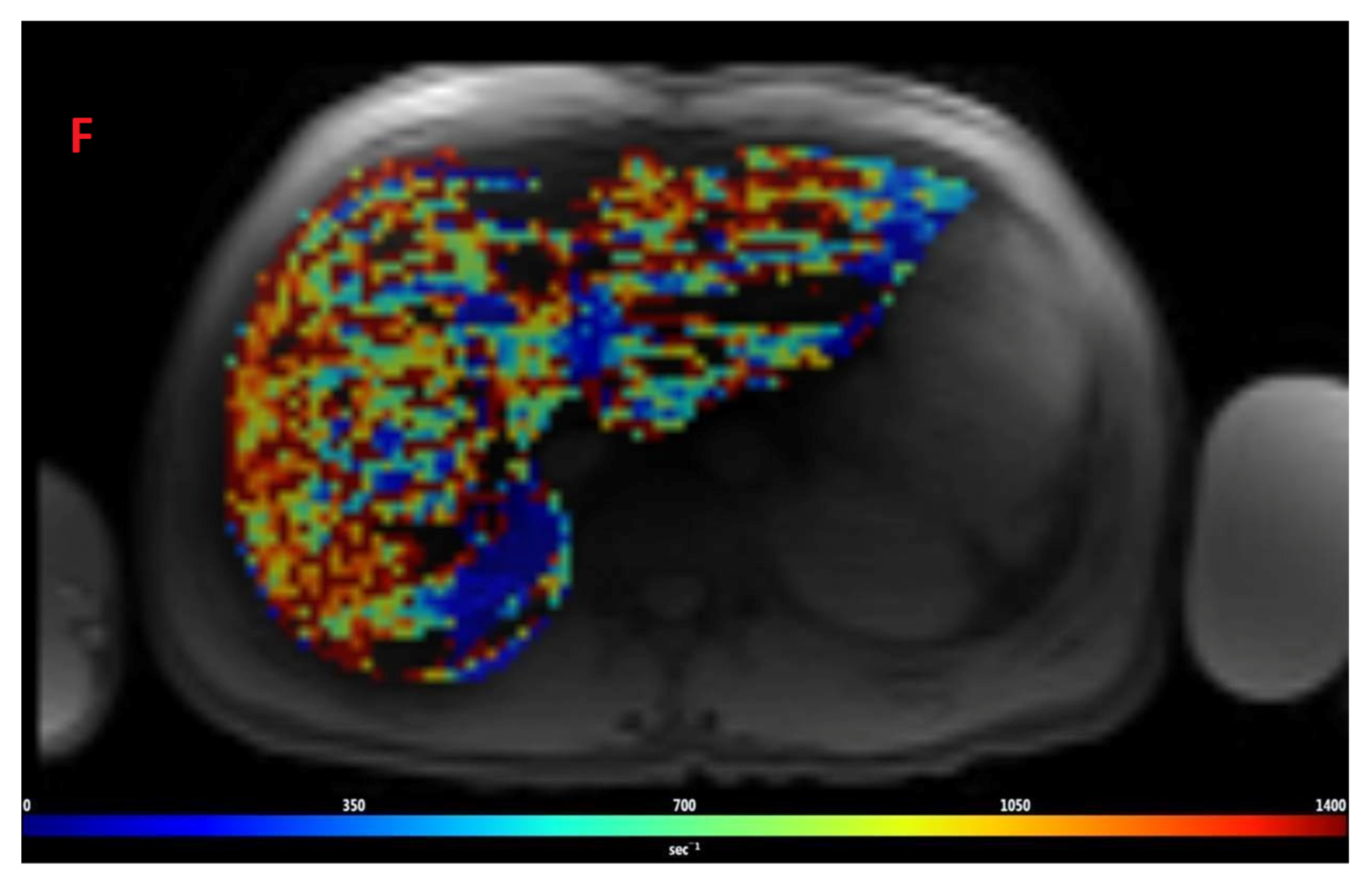 Tomography 08 00209 g002d Tomography 08 00209 g002d