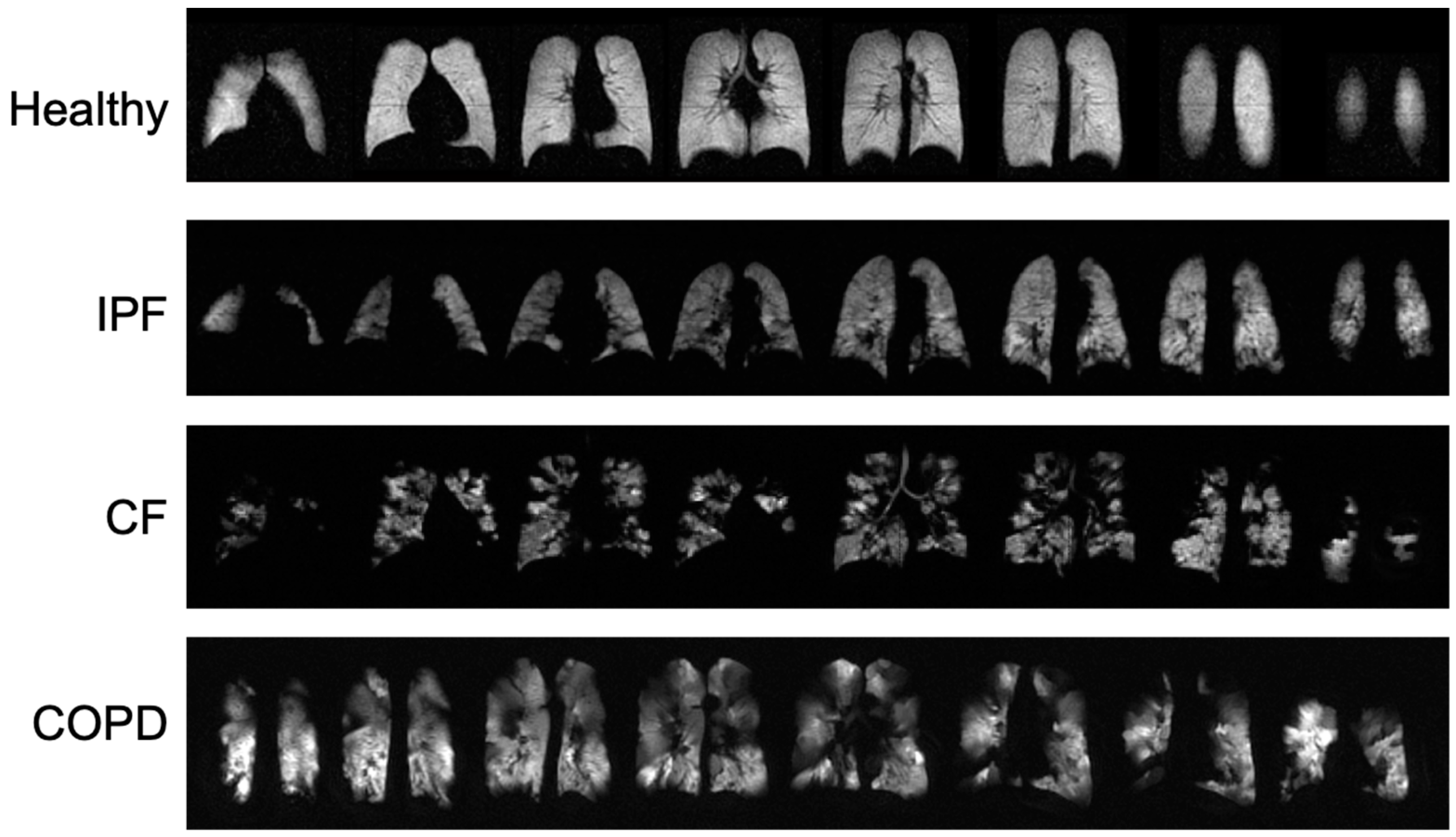 Tomography 08 00215 g001