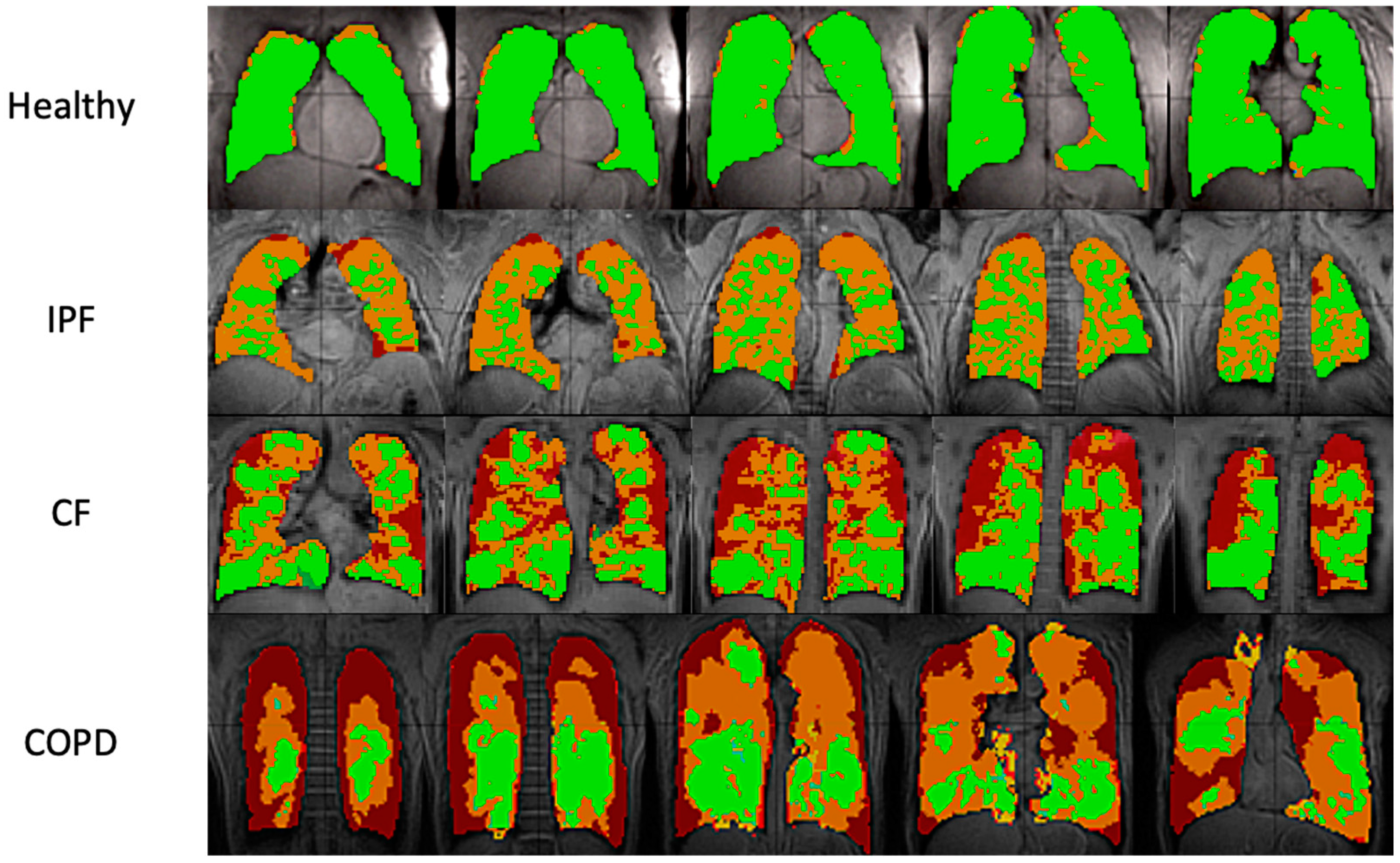 Tomography 08 00215 g002
