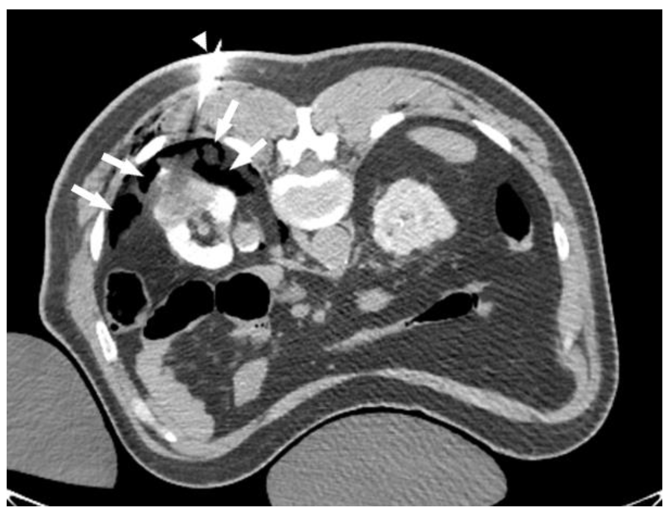 Tomography 08 00217 g002
