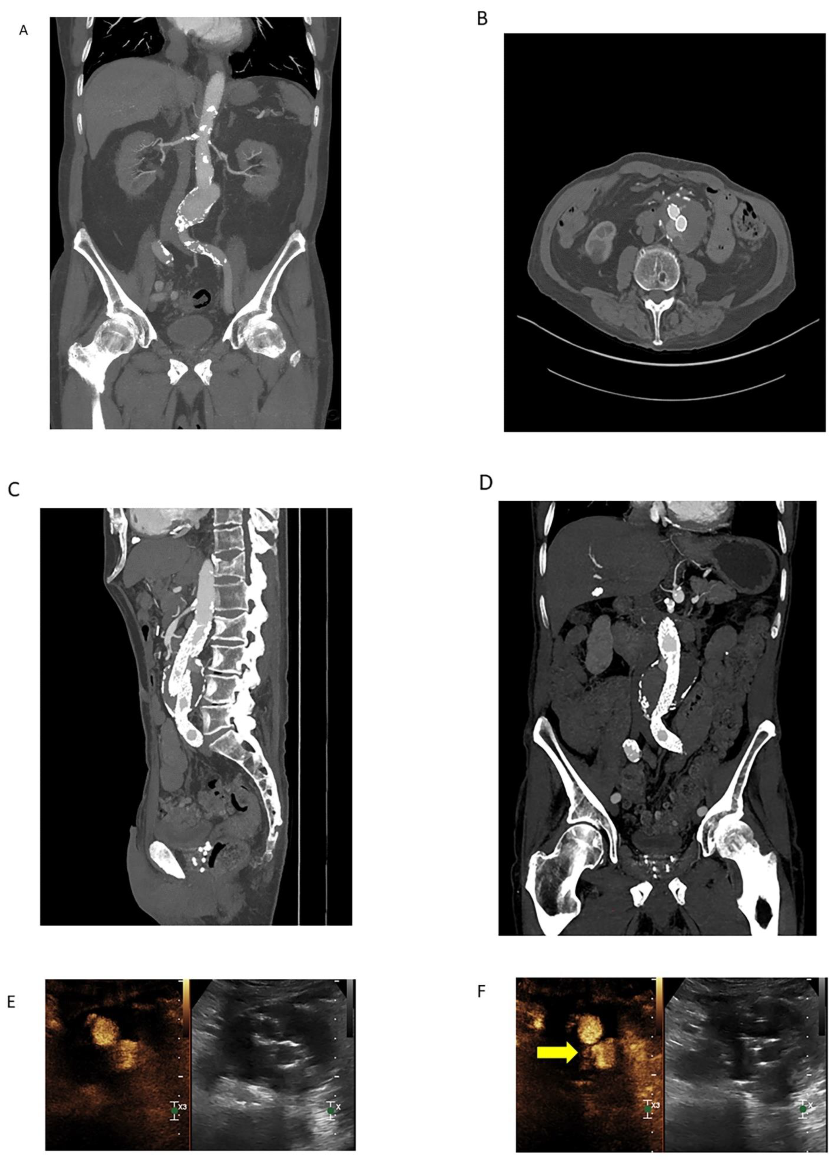 Tomography 08 00219 g003a
