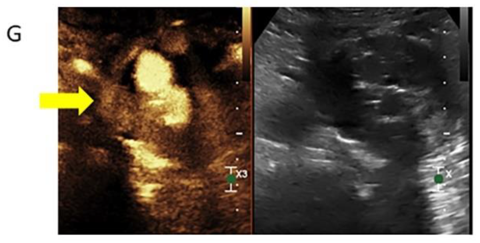 Tomography 08 00219 g003b