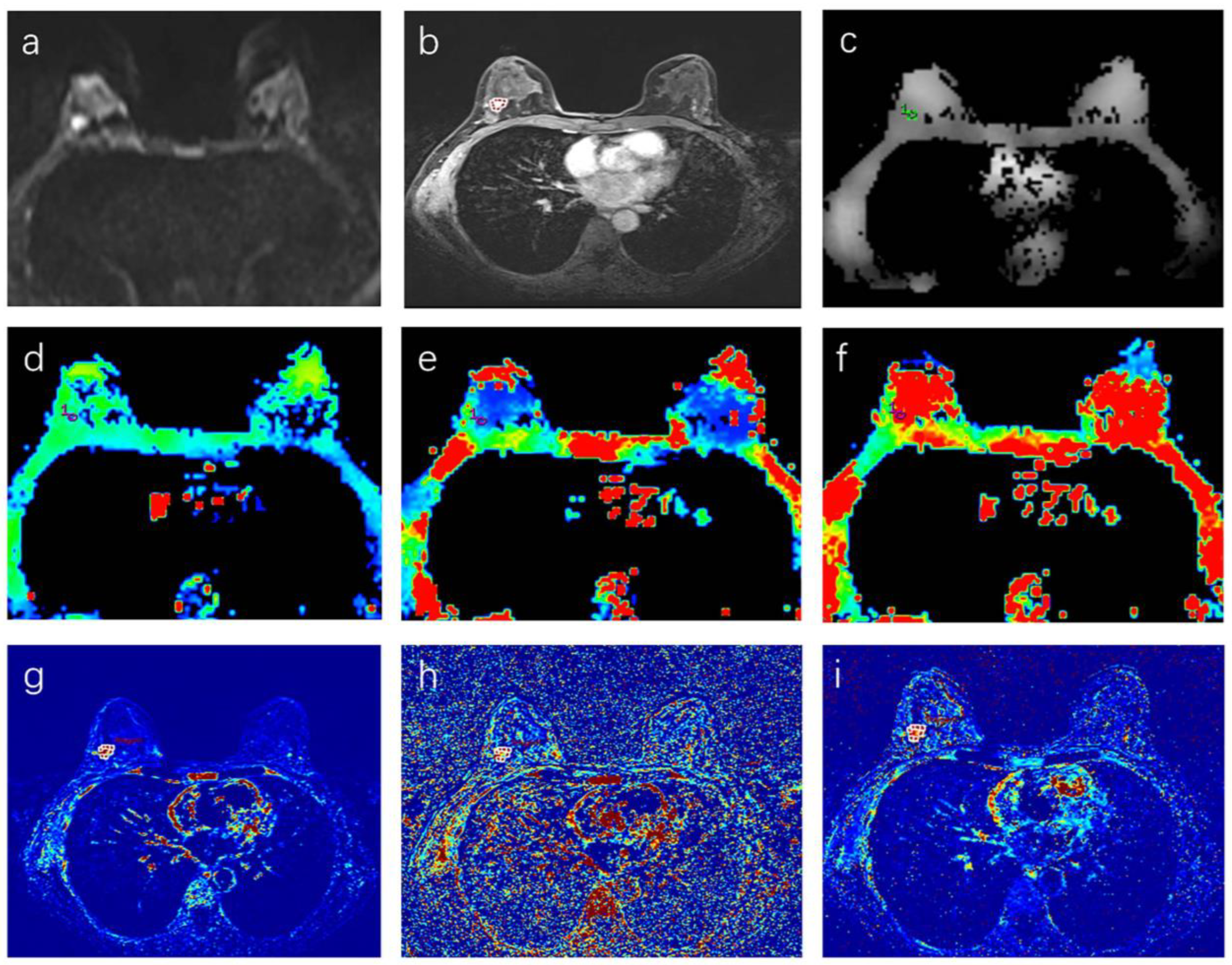 Tomography 08 00223 g001